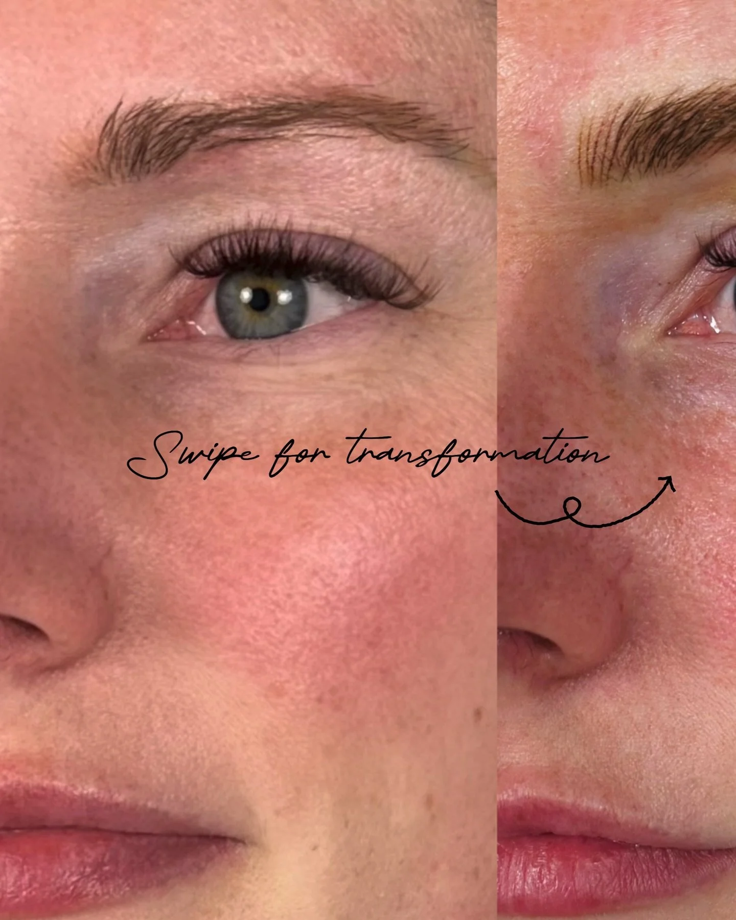 Beautiful transformation for this sweet client ♡
A soft brow that added natural shape, definition ✧

Book your brow appointment through the link in bio.

#NanoBrows #PhillyBrows #BrowTransformation #pmu #philly