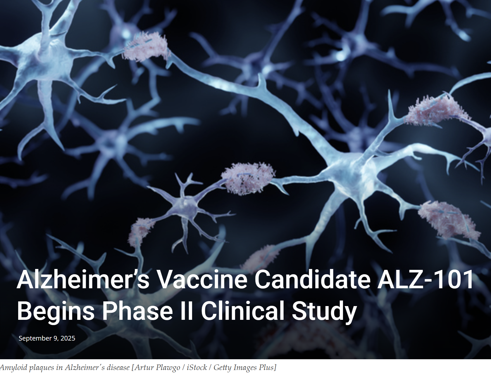 ALZ-101 Update 9.9.25a.png