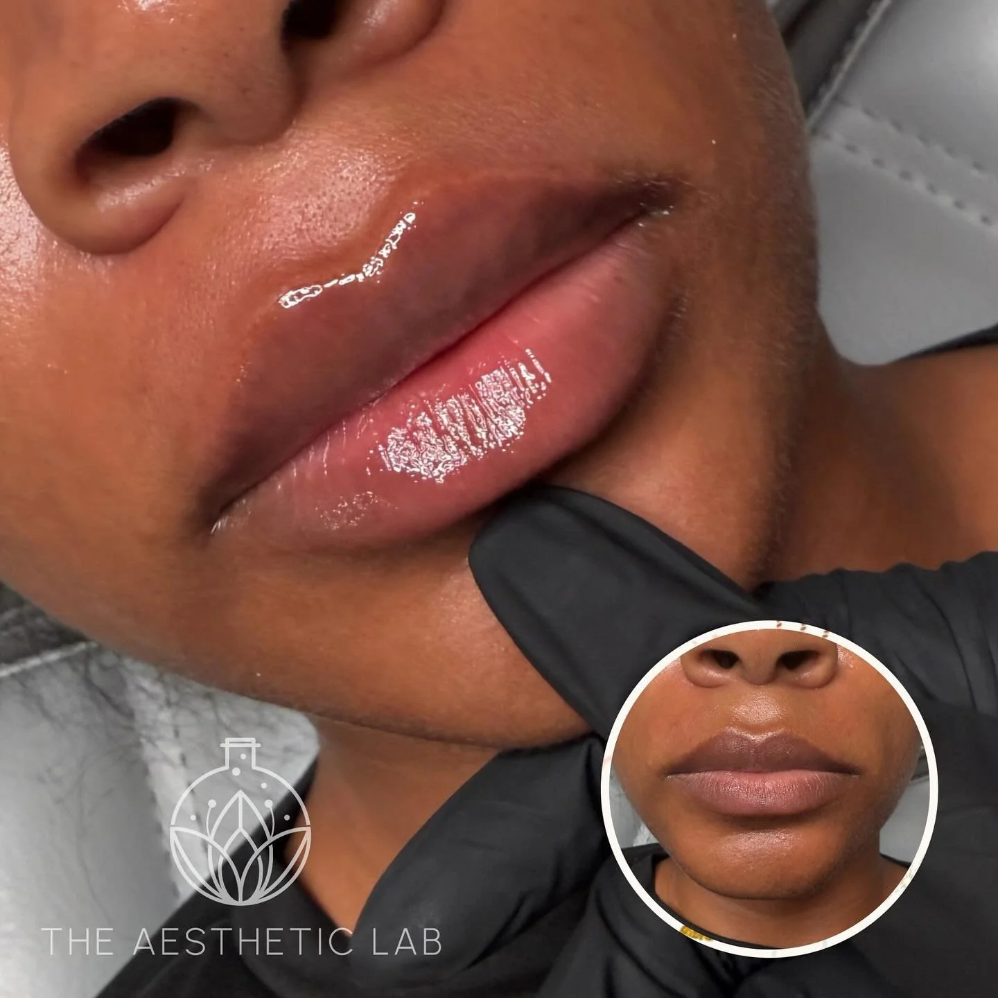 ✨ The art of lips. ✨
Lip filler is more than volume — it’s shape, balance, and harmony. One of my favorite specialties as an injector is crafting lips that enhance your natural beauty while staying true to you.
Ready to elevate your pou