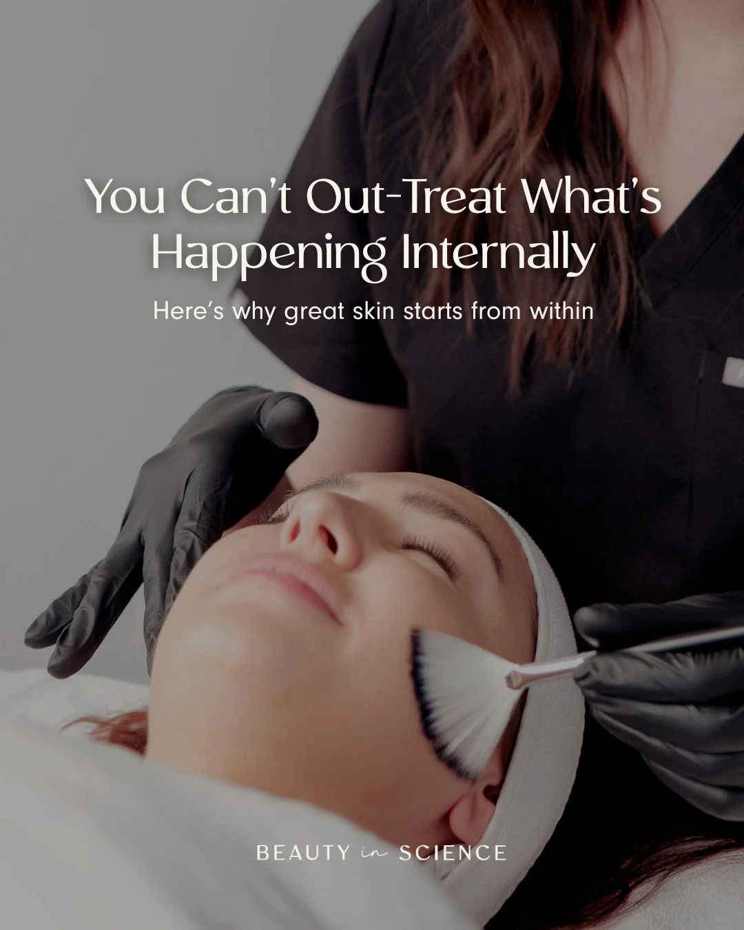 You can invest in the best skincare, the best facials, the best injectables... But if internal stress, hormones, inflammation, or nutrient deficiencies aren&rsquo;t supported, your skin can only respond so much.⁠
⁠
Great skin isn&rsquo;t just about w