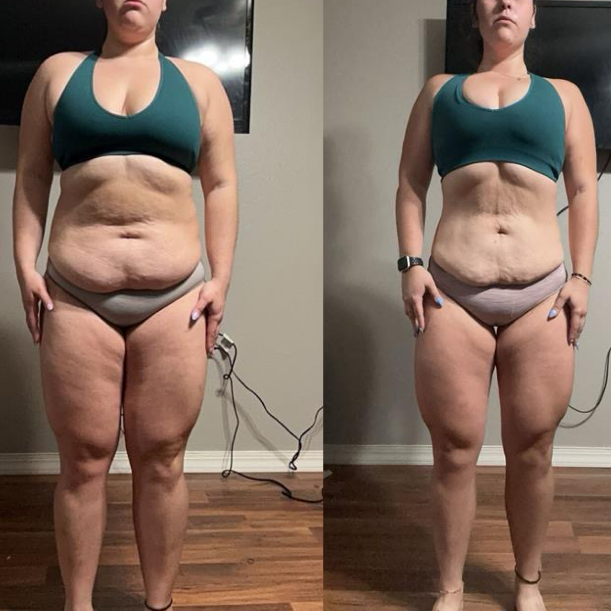 Side-by-side comparison of a woman before and after weight loss, standing in front of a wall with a TV, wearing a green sports bra and beige bottoms.