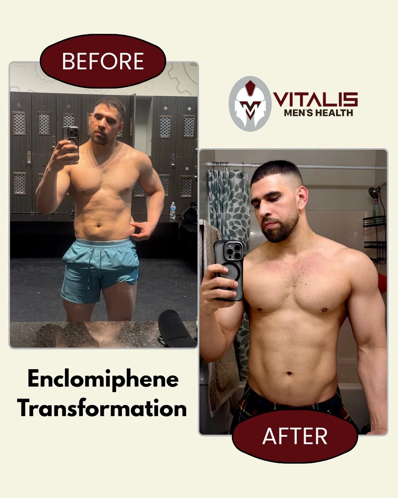 Big shoutout to our patient Raul for his amazing Enclomiphene transformation! His hard work and discipline show just how powerful the right treatment can be when paired with consistency in the gym and a clean diet. 

Remember, no therapy works in iso