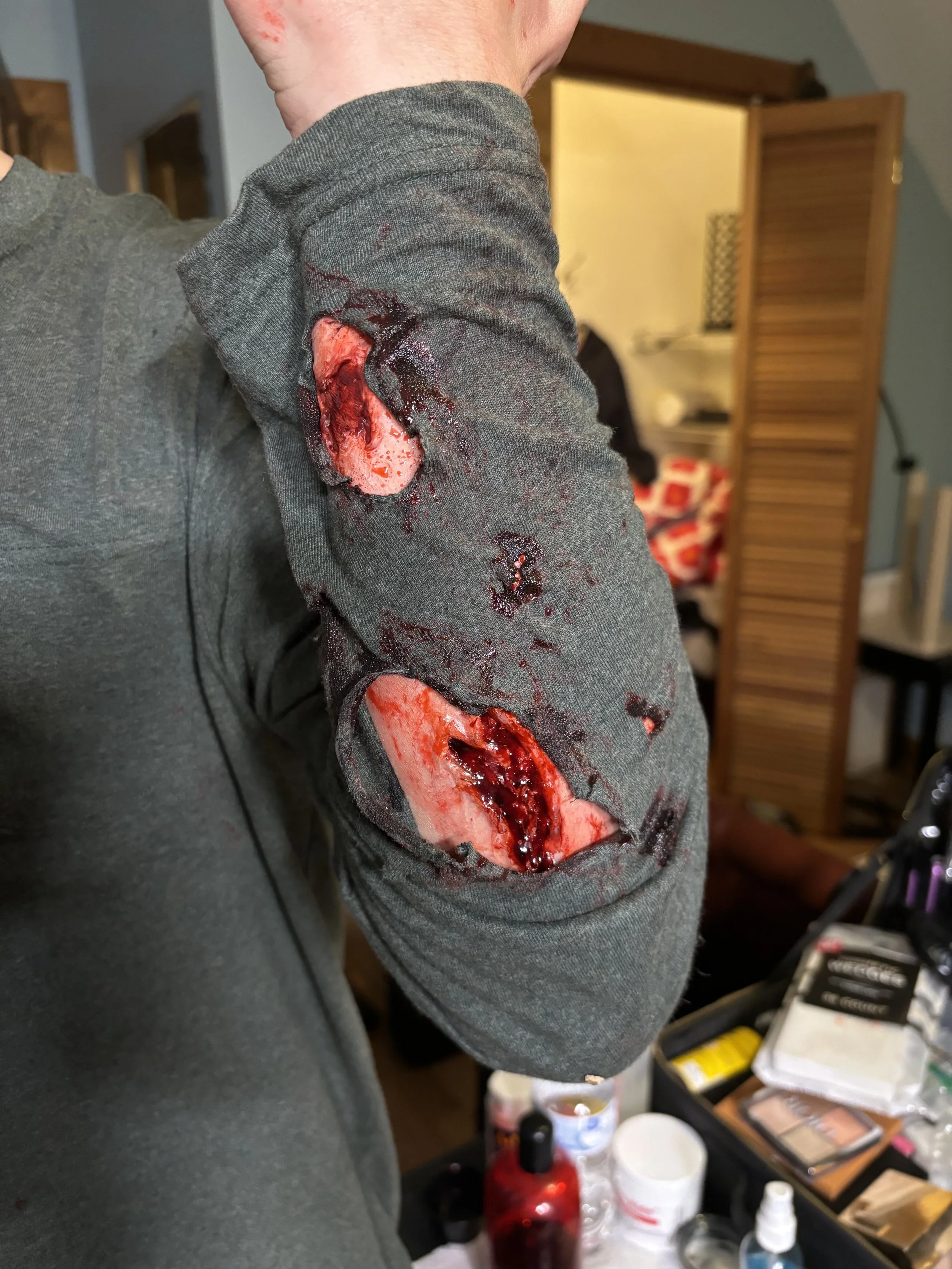 hammerwound1.jpg