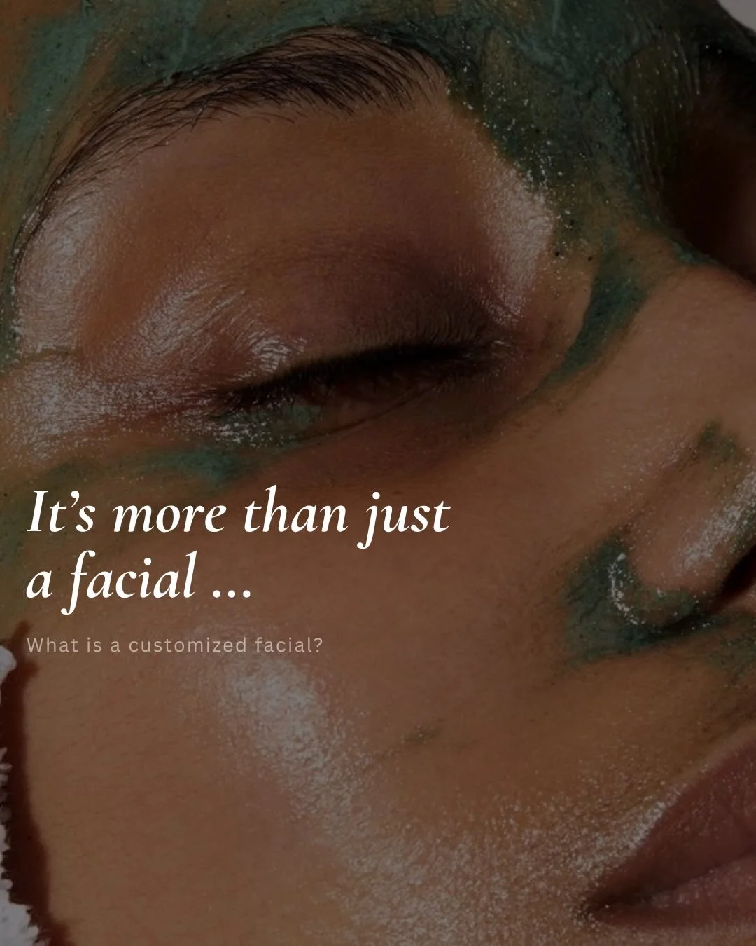 Scroll to the end to see a before &amp; after from just one customized facial 🤍
This is why we don&rsquo;t follow a set routine in the treatment room.

Your skin isn&rsquo;t the same every visit so your facial shouldn&rsquo;t be either.

Each treatm