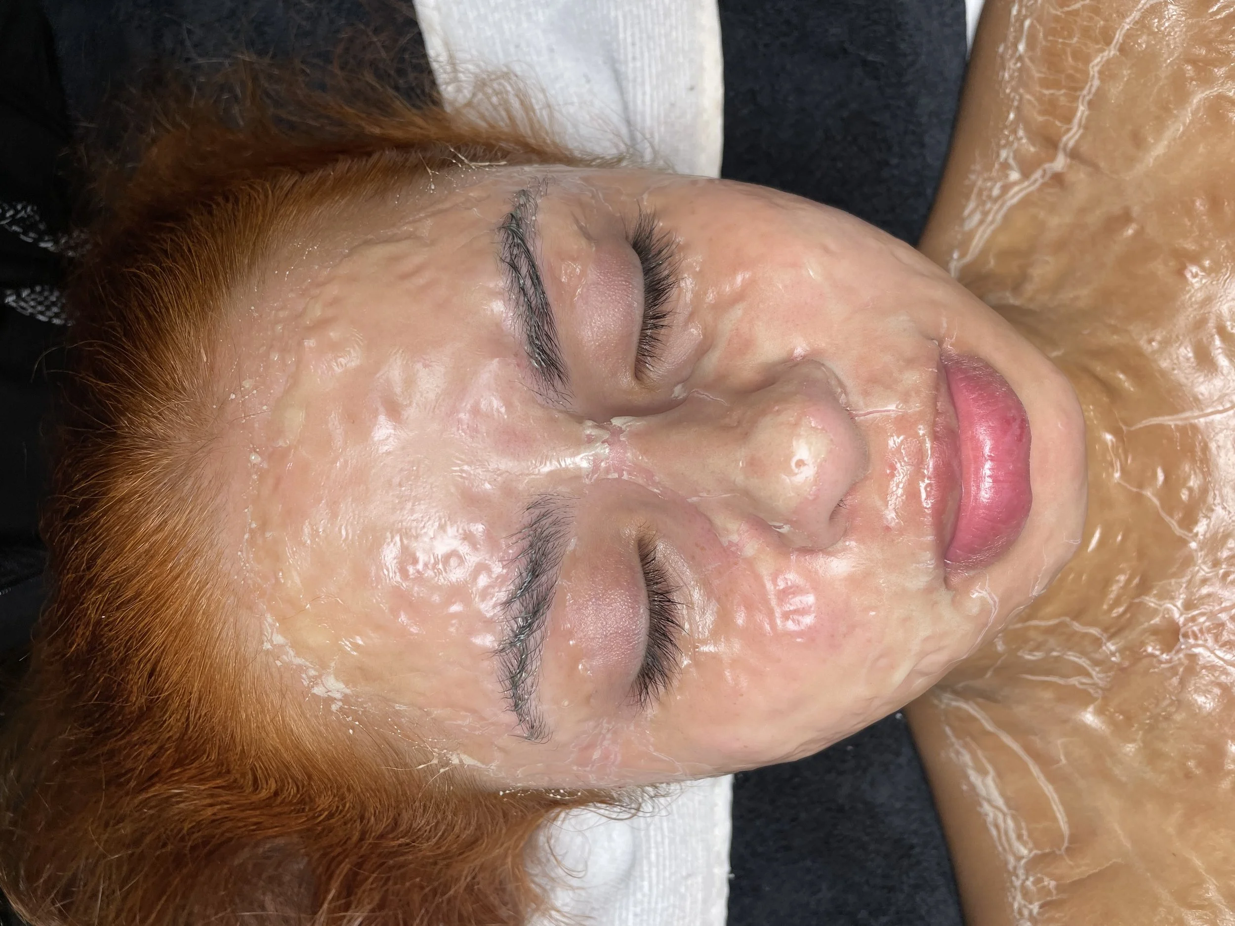 client getting dmk enzyme therapy in smithtown