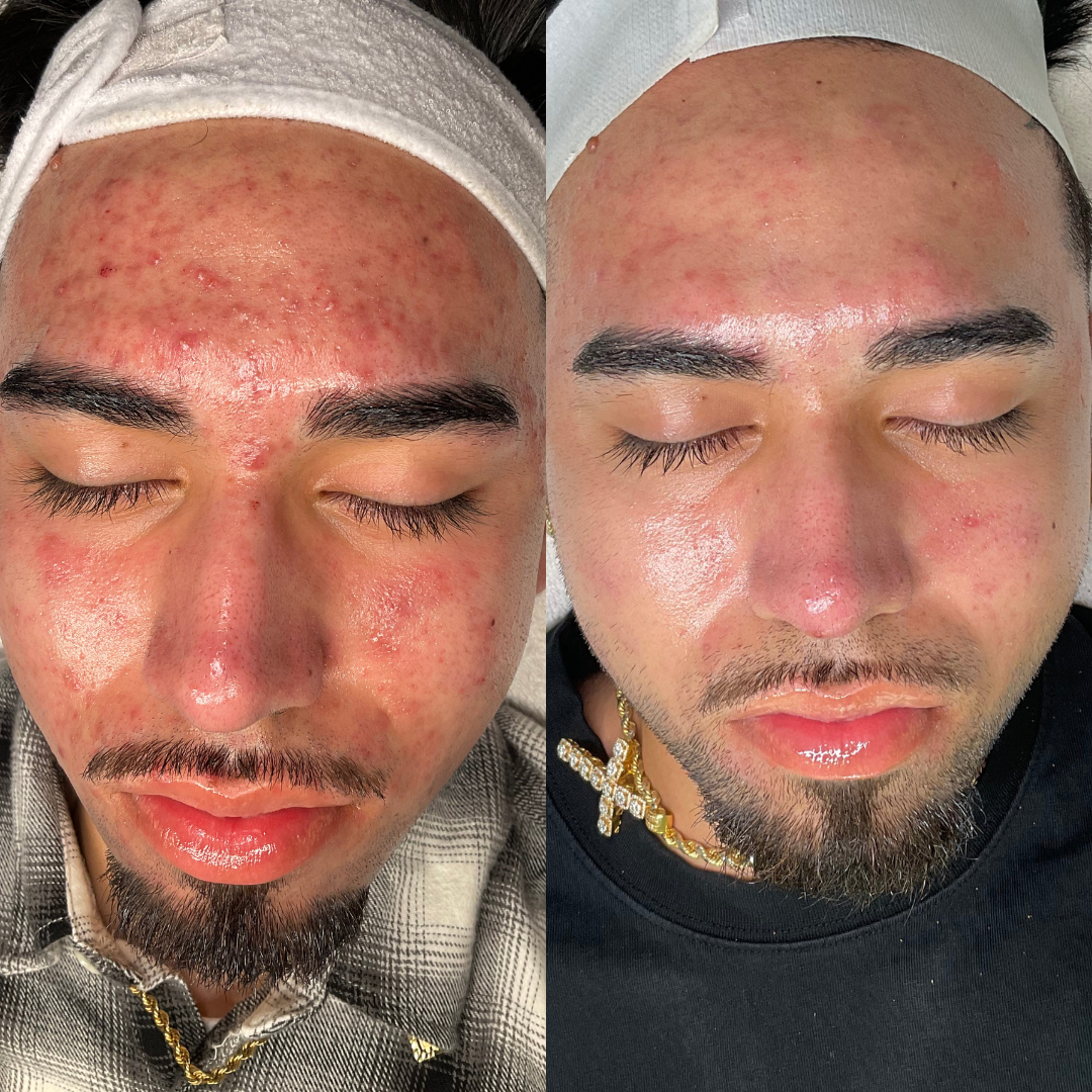 Alexis Hernandez .png