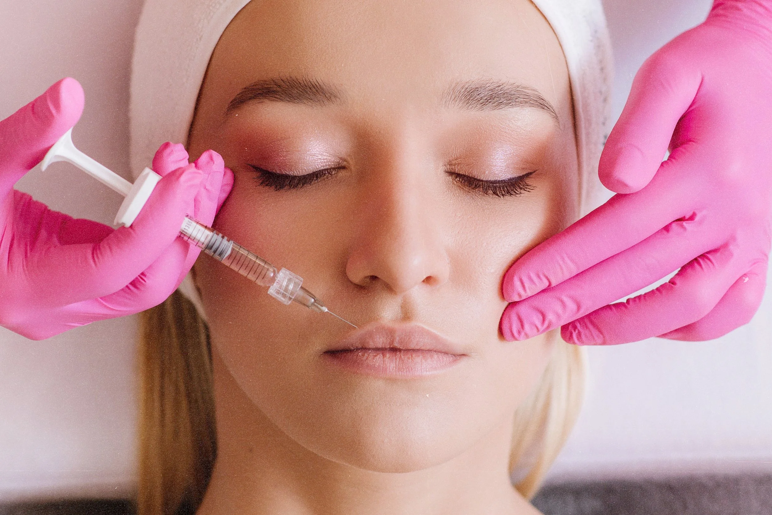Patient receiving filler for lip line smoothing at Birmingham clinic.
