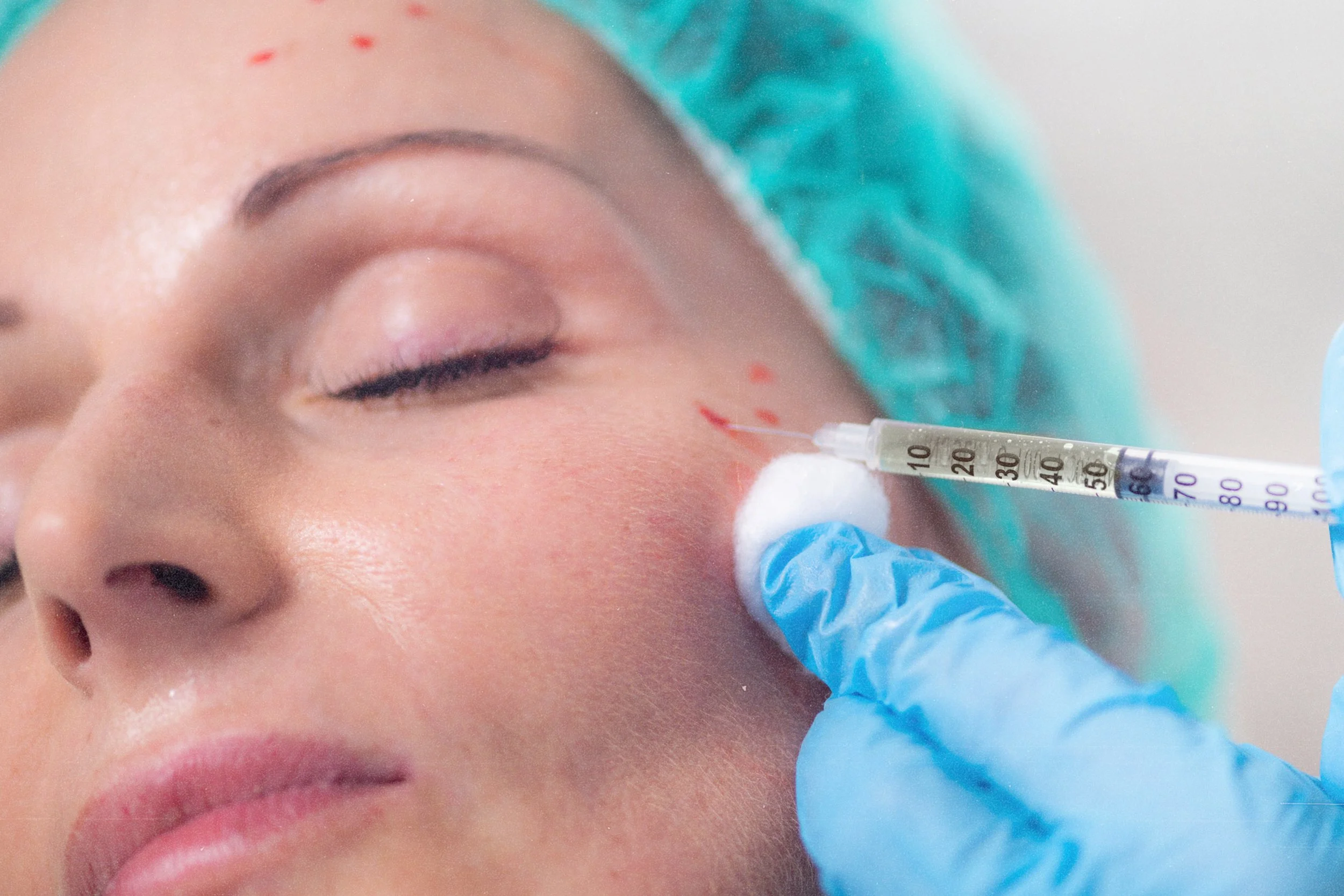 PRP skin rejuvenation therapy for collagen production and youthful skin in Birmingham.