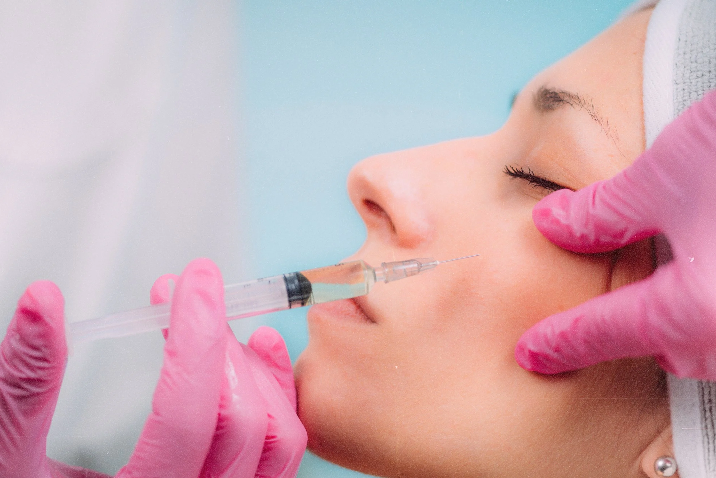 Cheek enhancement with dermal fillers for youthful look in Birmingham.