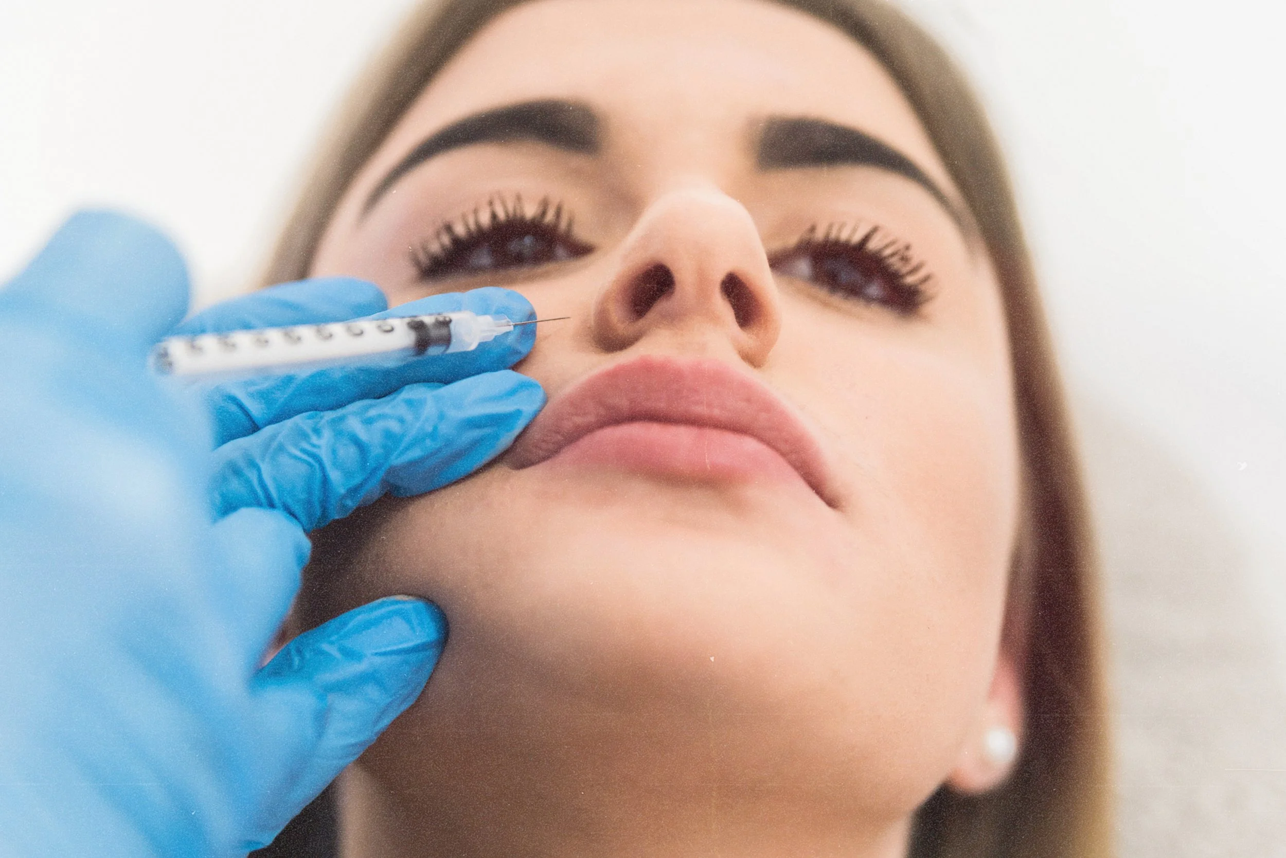 Botox for gummy smile correction at Birmingham aesthetic clinic.