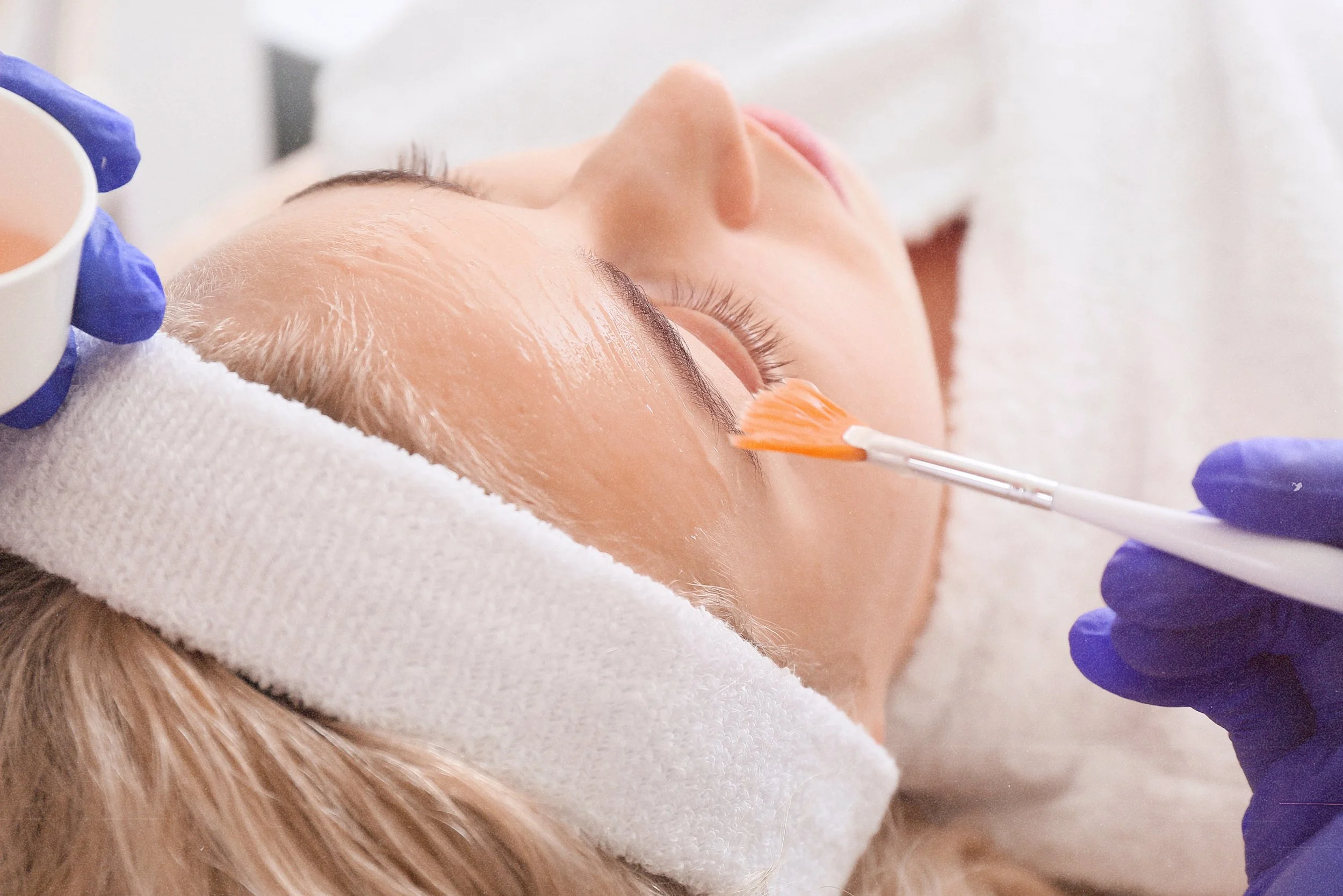 Chemical peel treatment for smoother, radiant skin at Birmingham aesthetics center.