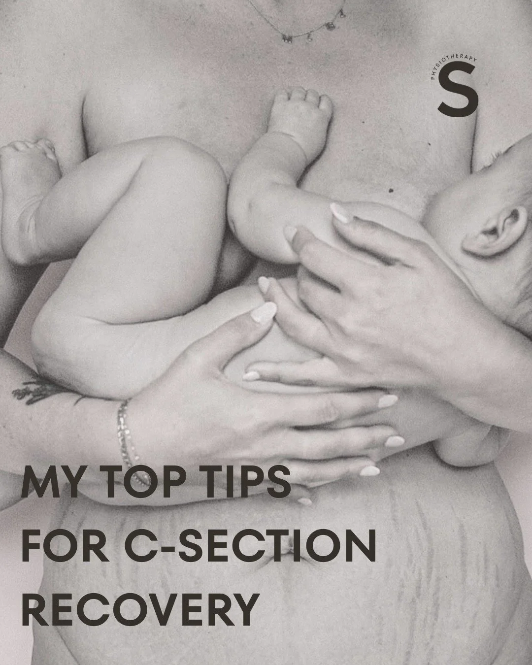 My Top Tips for Early C-section Recovery

Whether planned or unplanned, recovery after a c-section can feel daunting, but it doesn&rsquo;t have to be. Save this or share it with a friend who might find it helpful!

.
.
.

#csectionrecovery #postpartu