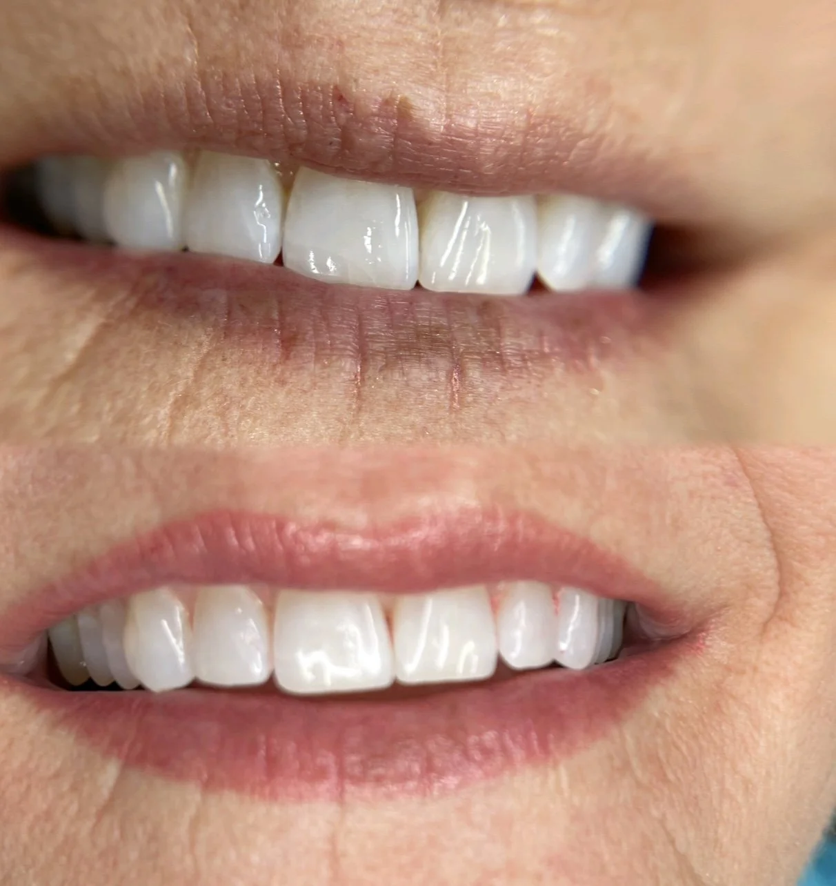 BEFORE & AFTER LIP BLUSHING