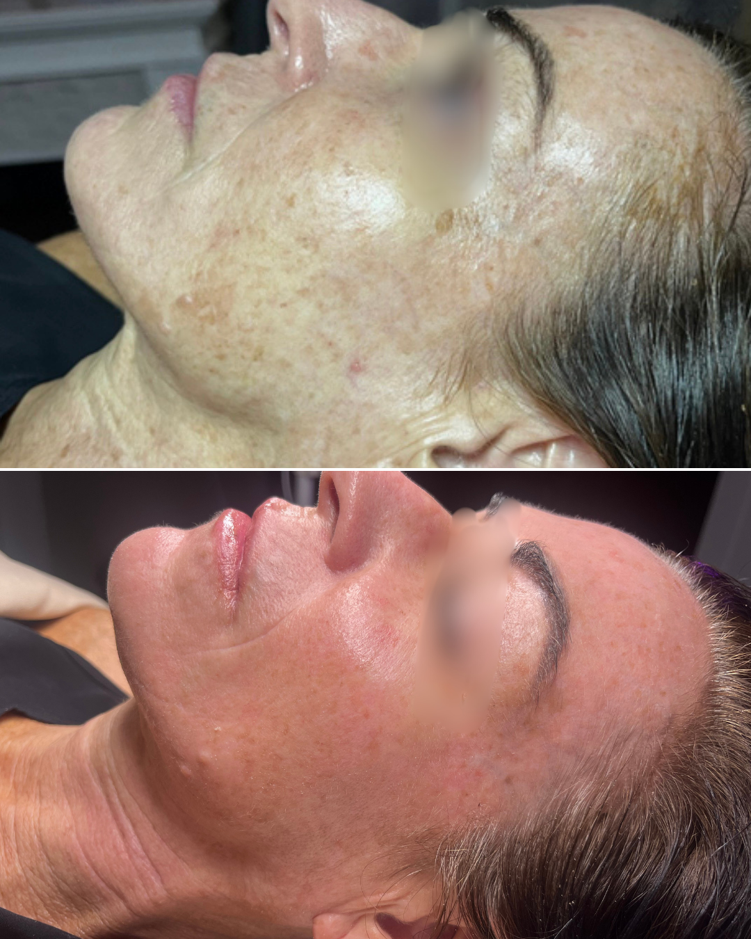 Beige Minimalist Beauty Before After Collage Instagram Post - 1.png