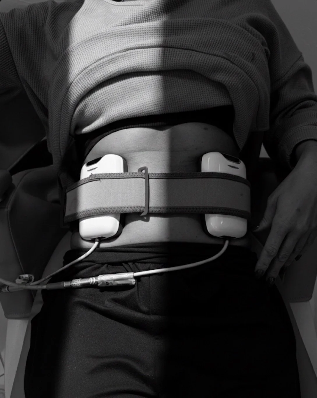 Person wearing a medical device around the stomach, with wires connected to it, on a hospital bed.
