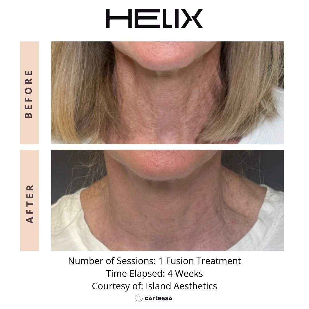 Helix9a172770570997.jpg
