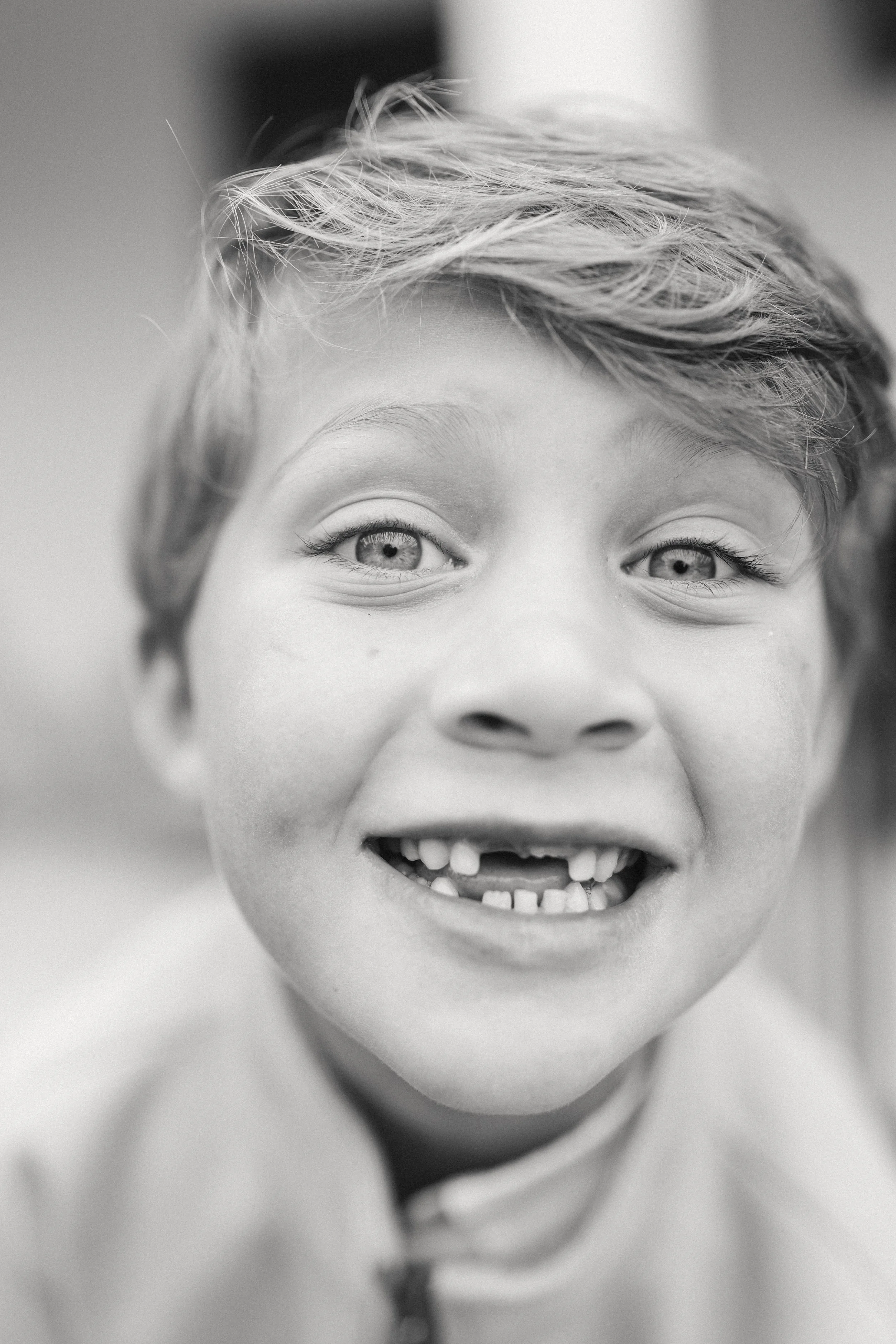 Close-up of a young boy with light-colored, tousled hair, smiling and showing missing and crooked teeth, in black and white.
