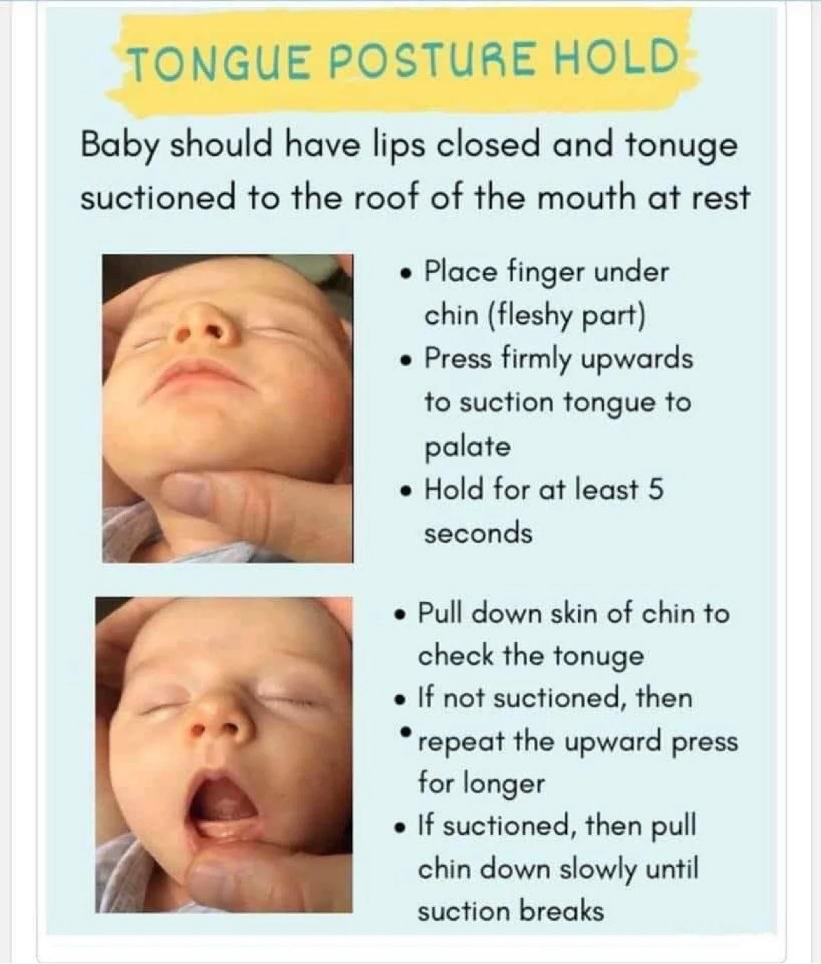 Instructional poster demonstrating how to perform a tongue posture hold on a baby, including steps to place a finger under the chin, press upwards to suction the tongue to the palate, hold for at least 5 seconds, and check if the tongue is properly suctioned.