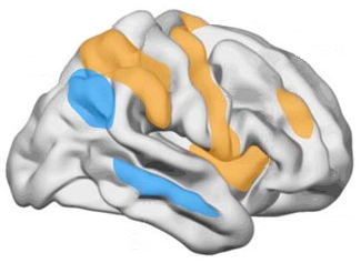 Picturing the Secrets of the Extraordinary ADHD Brain — Spoonful of ...