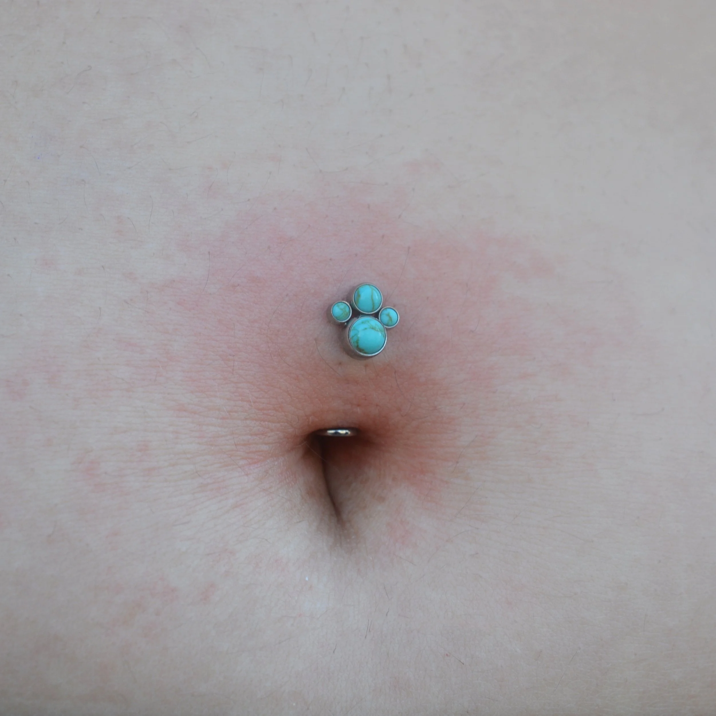 sam, inverted navel pt2, anato.JPG