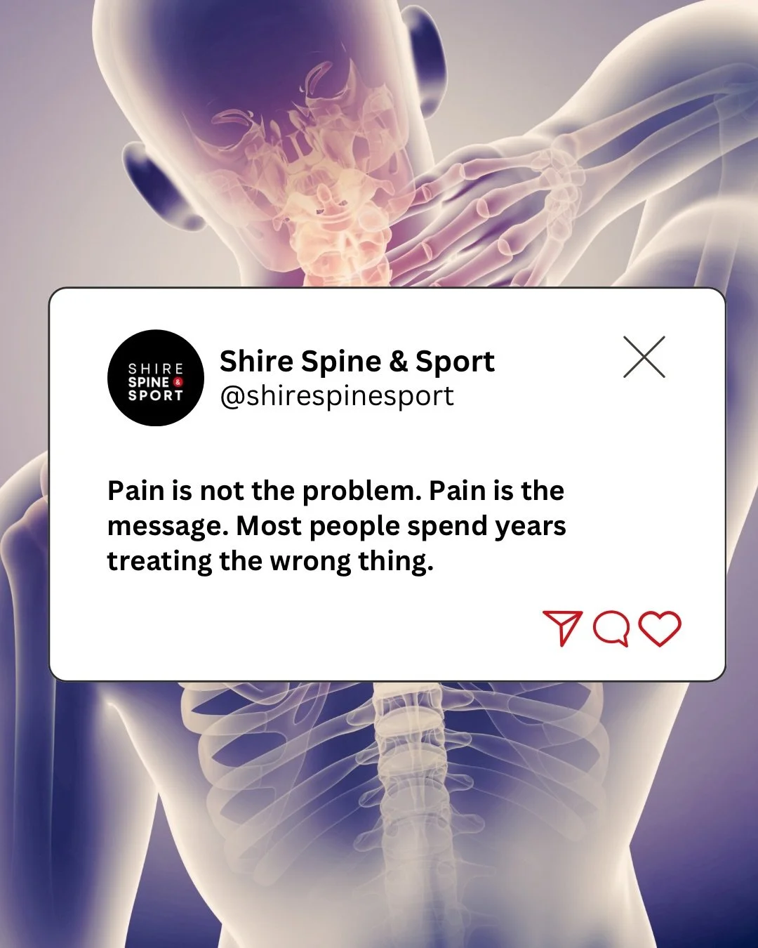 Chasing pain with no real answers? That&rsquo;s what we are here for.

#shirespinesport #pain #rebuild