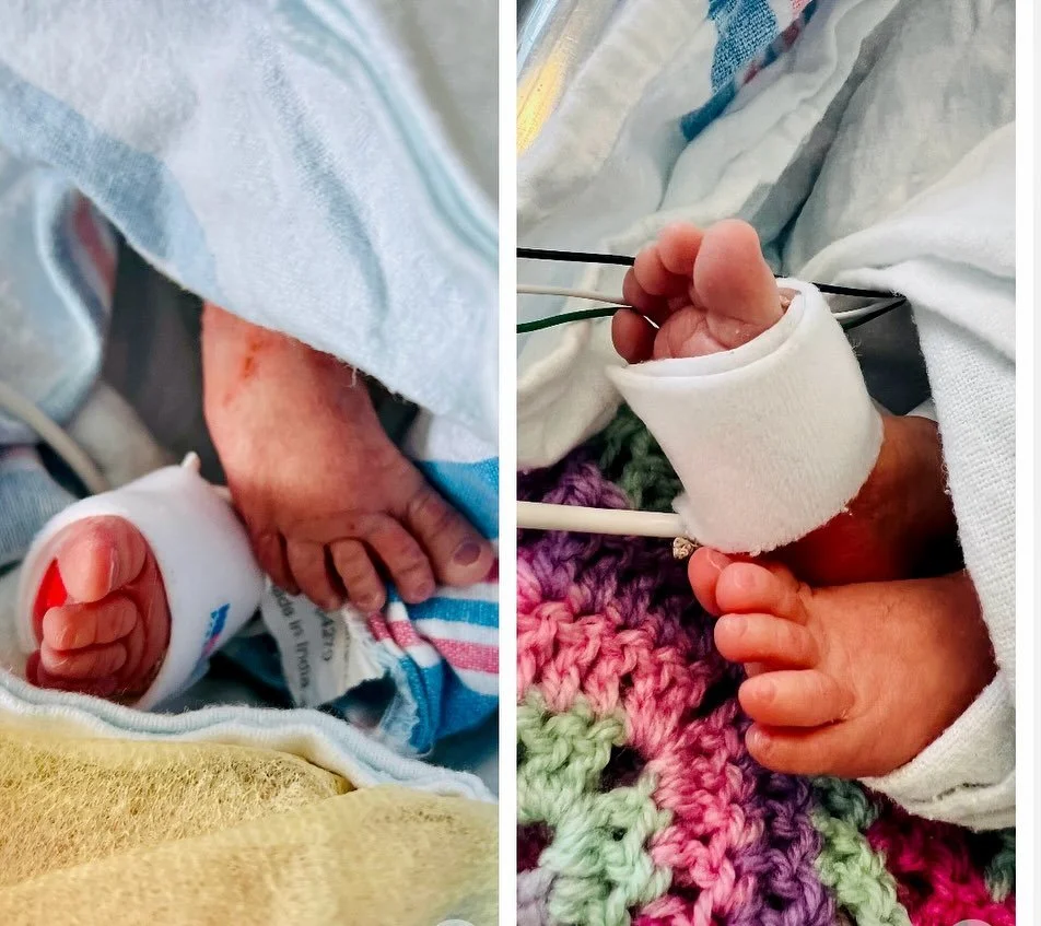 This is three 🥳🫶 I love looking back at their little 4 and 5lb pictures, seeing how small but strong they already were. 

This day three years ago I went in for a routine NST appointment at 33 1/2 weeks and was told I was contracting, to go to the 