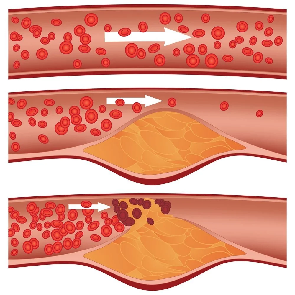 Deep Dive into Cholesterol