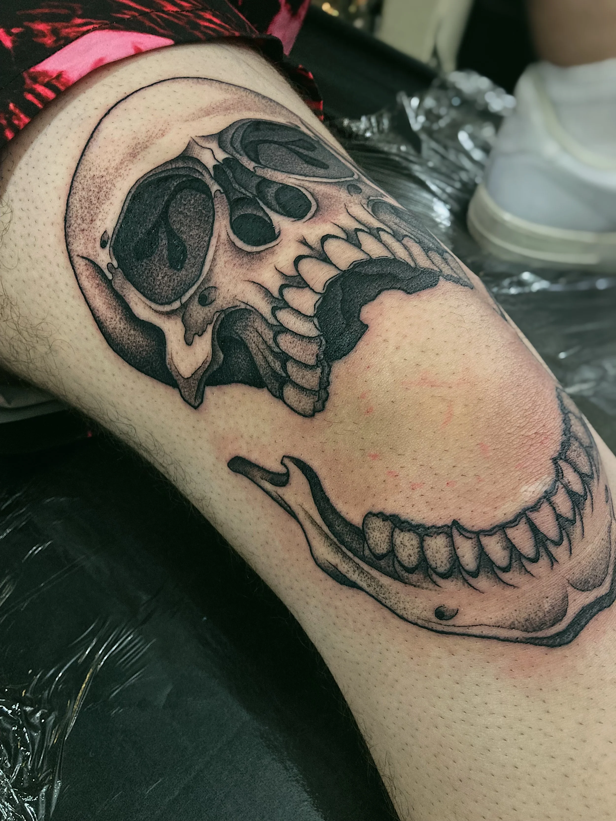 skull on knee.JPG