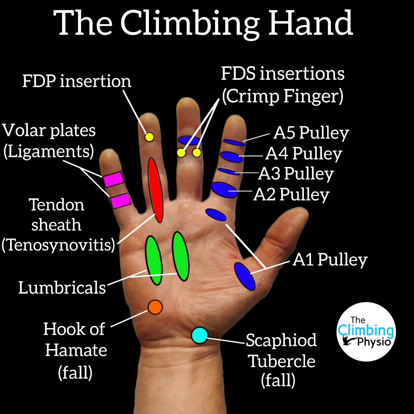 Our hands are both incredibly resilient and beautifully intricate at the same time. When specific parts of the hand become painful symptoms can often (but not always) be replicated by touch. 

Here are some examples of hand pain that I frequently enc