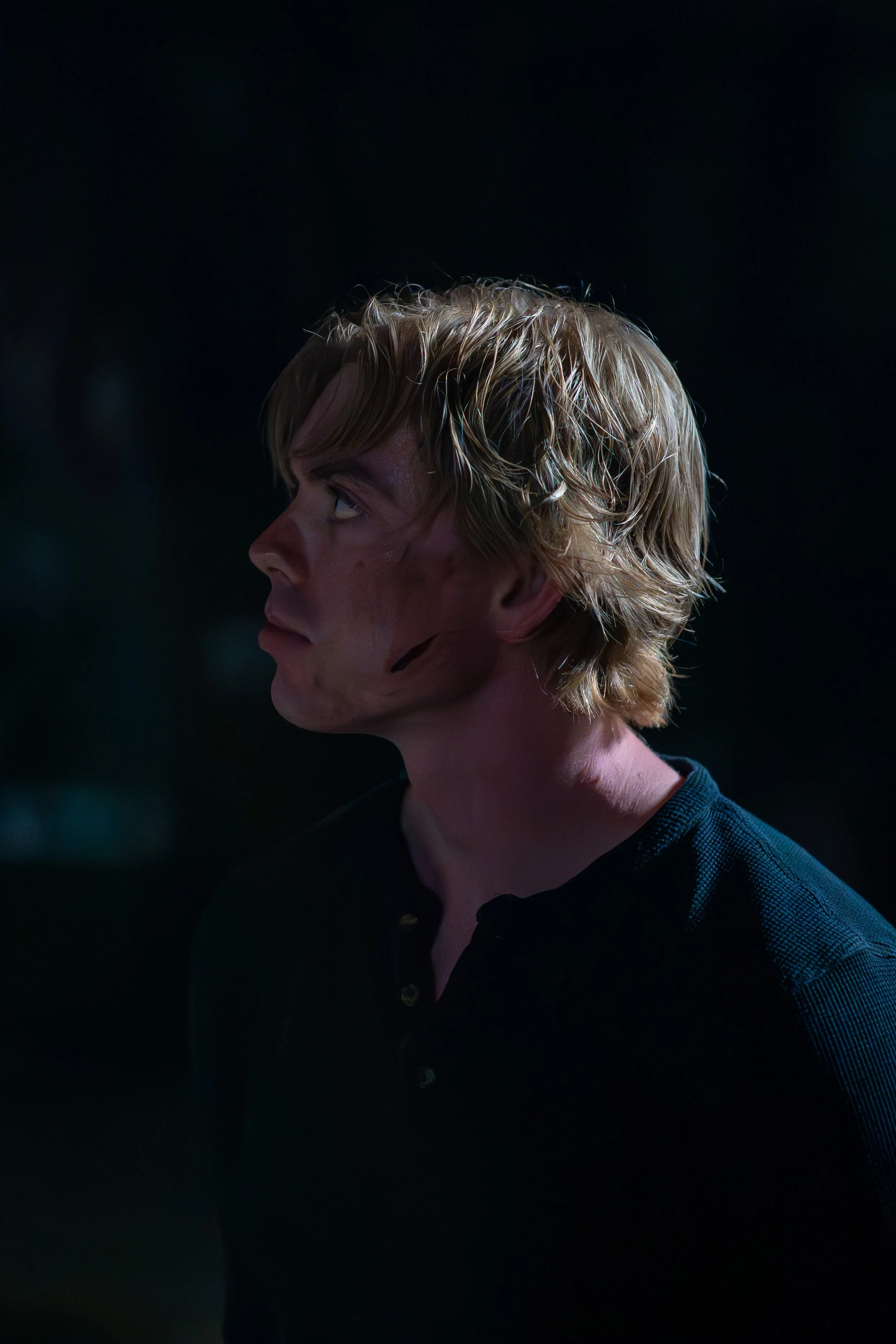 Side profile of a young man with blond hair, wearing a dark shirt, with visible scars and scratches on his face and neck, against a dark background.