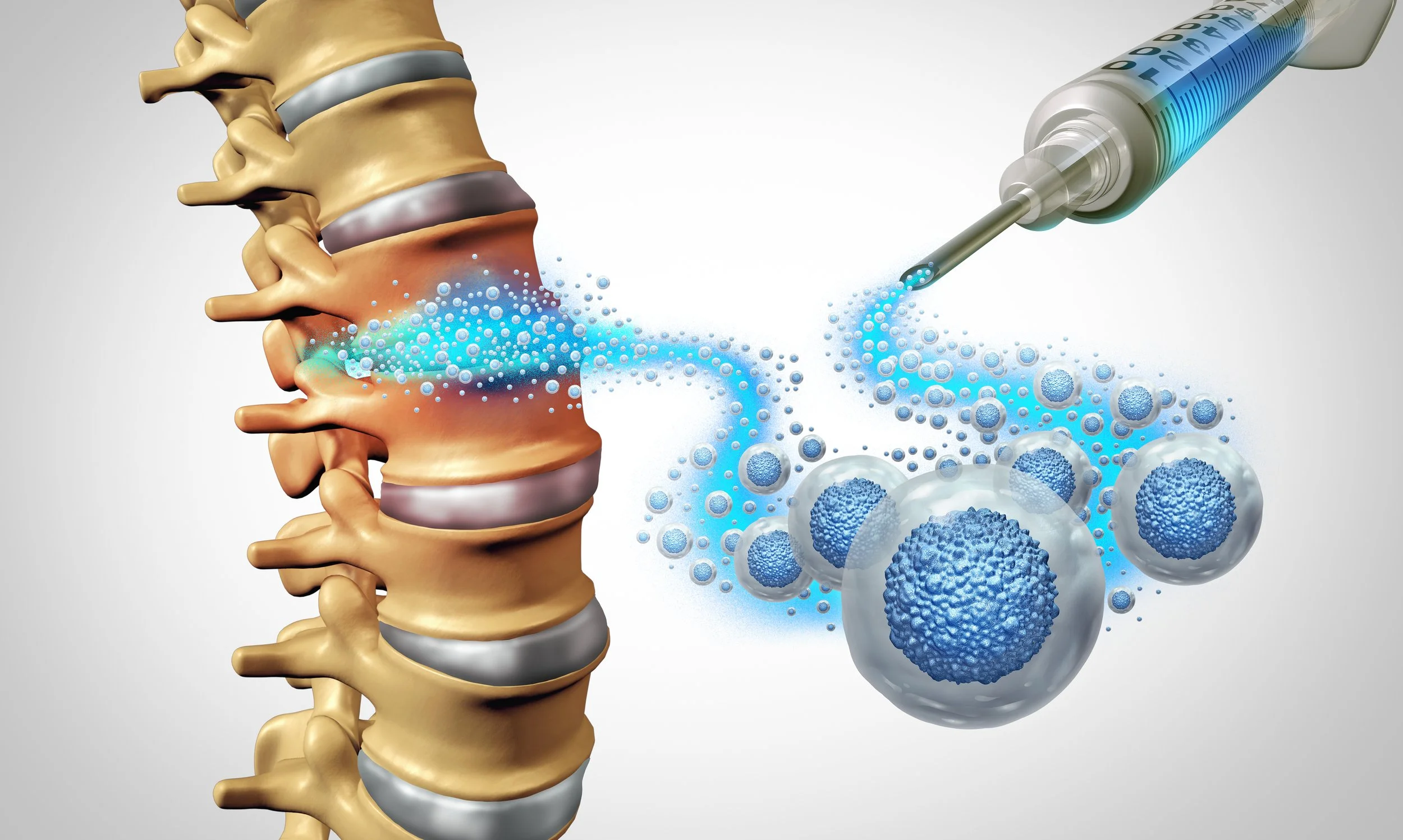Regenerative Cell Therapy