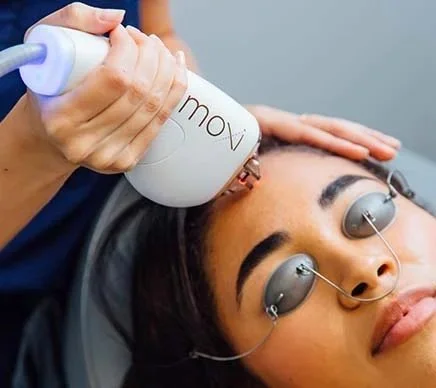1 Halo, 1 Moxi/BBL Treatment
