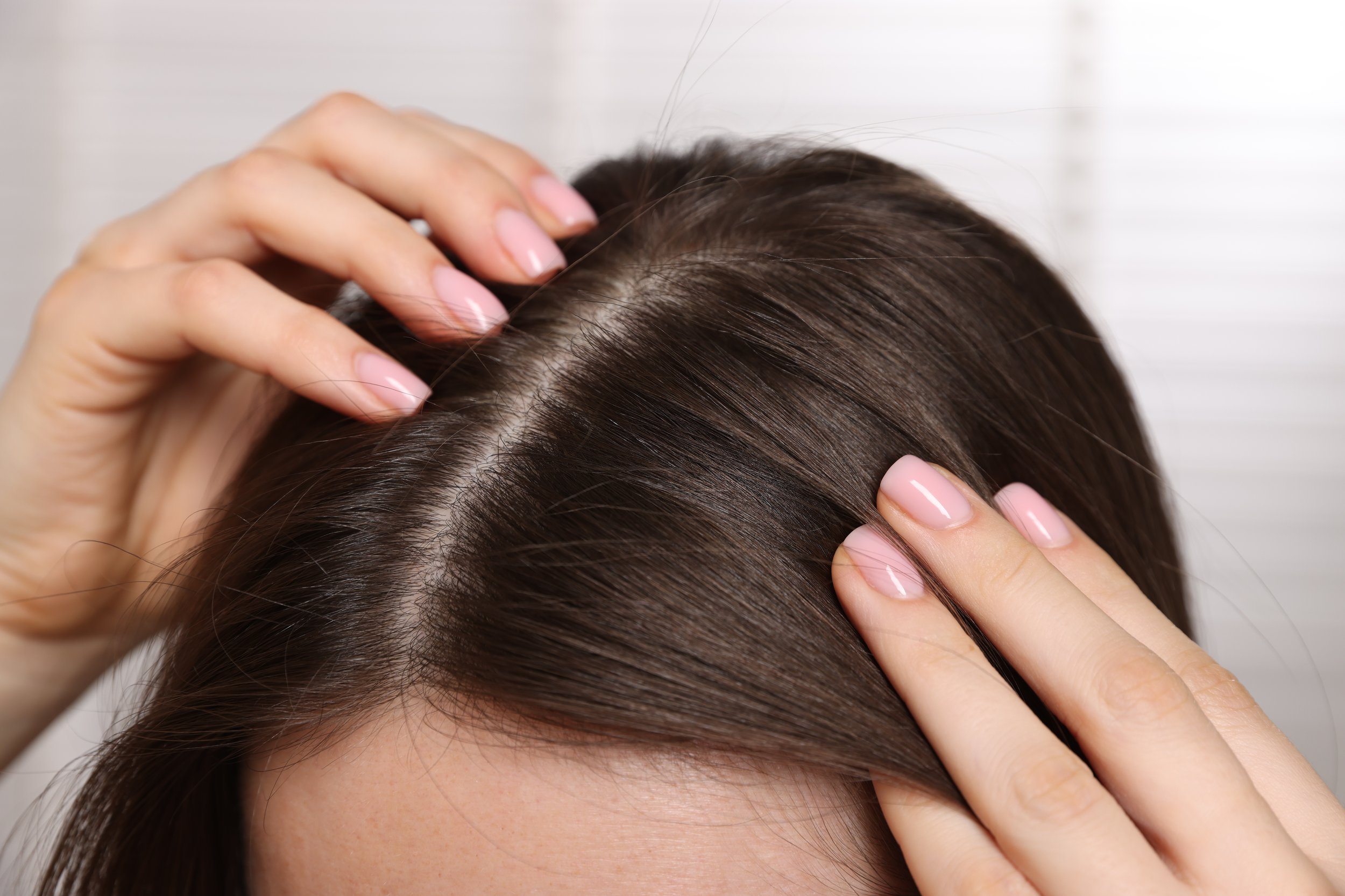 What Causes Hair Loss in Women (And When to See a Professional)