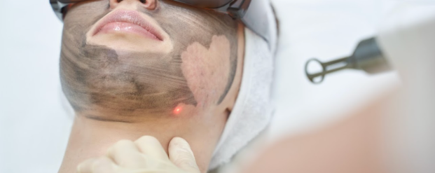 Understanding Laser Options for Sun Spots, Age Spots, Hyperpigmentation &amp; More