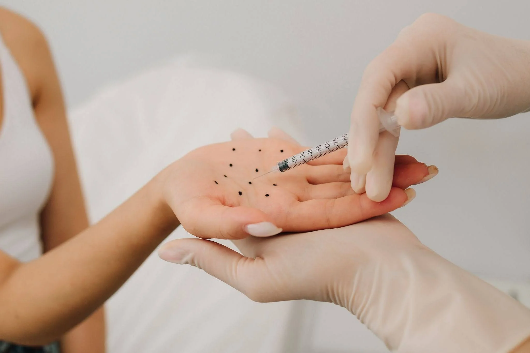 Close-up of clinician marking injection points on hands.