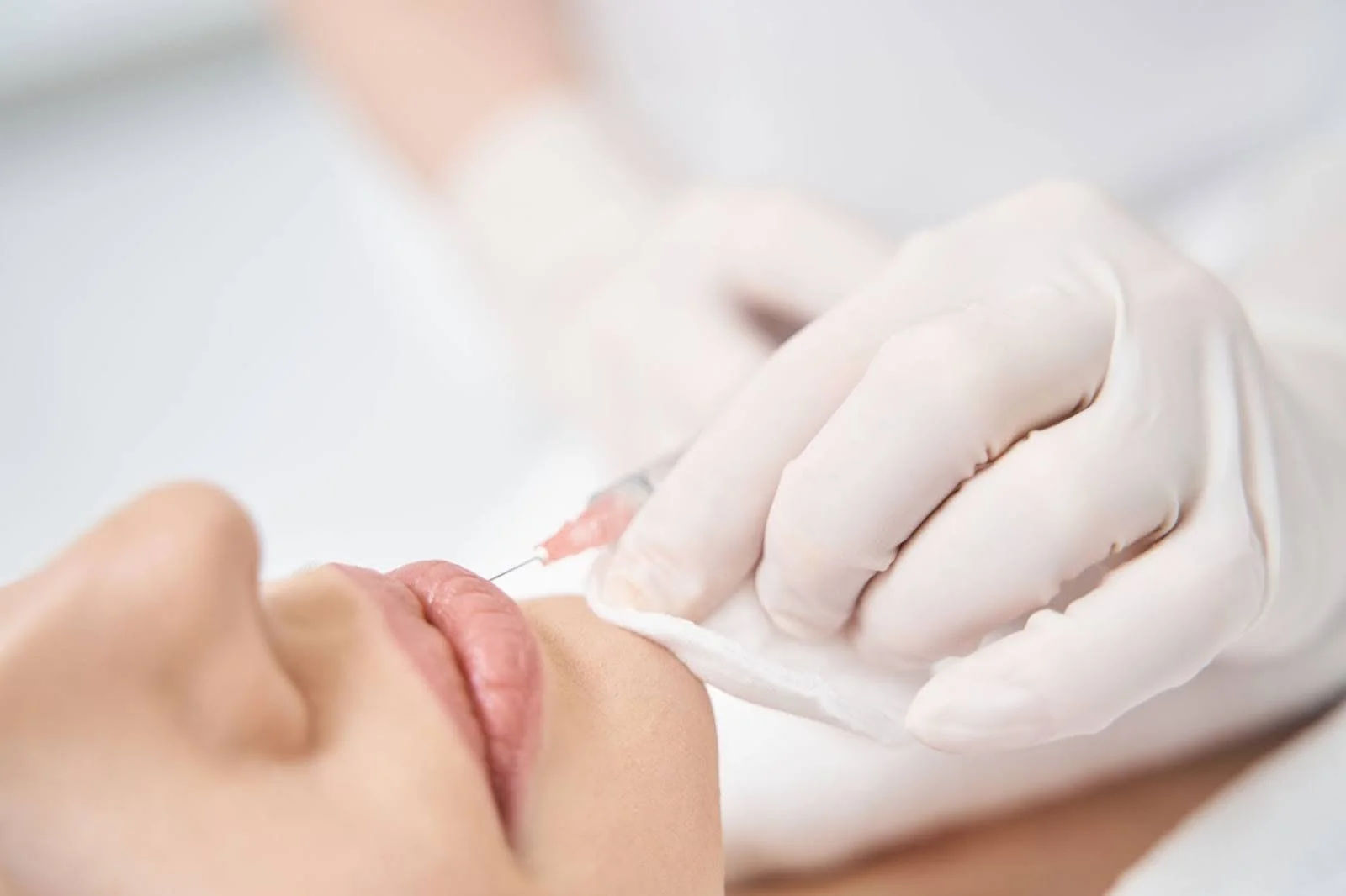 Lip augmentation procedure using injectable products in a clinical setting
