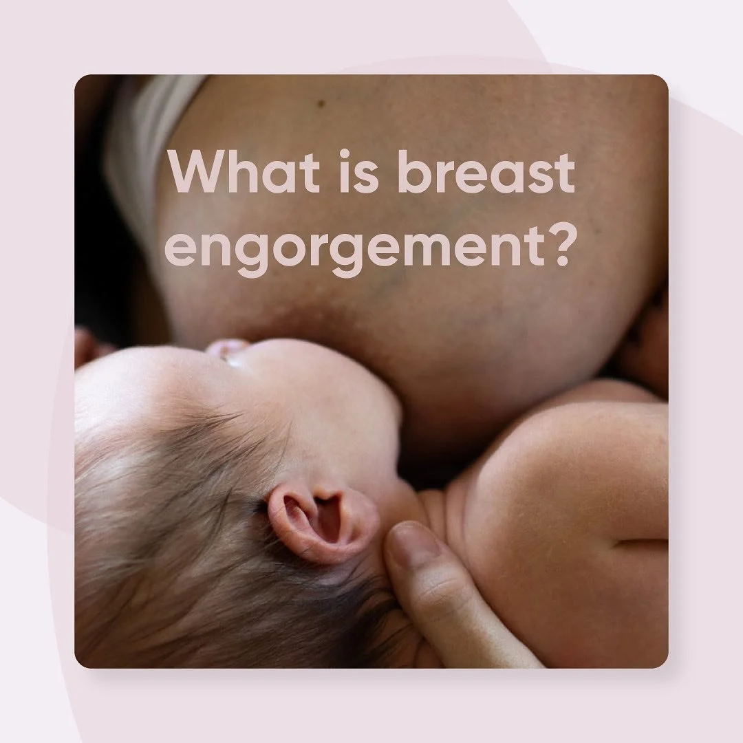 Feeling discomfort in your breasts during your breastfeeding journey? It could be breast engorgement&mdash;a common condition in the first 3 to 5 days when your breasts become overly full of milk.

Symptoms to watch for:

- Swollen, firm, or hard bre
