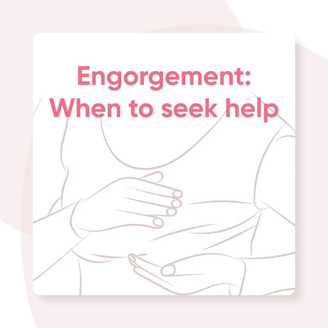 Dealing with engorgement and not sure when to seek help from professional? Read on.

Sometimes, breast engorgement needs a little extra attention. Reach out to a healthcare provider if:

- Your engorgement lasts more than a few days.
- You develop fe