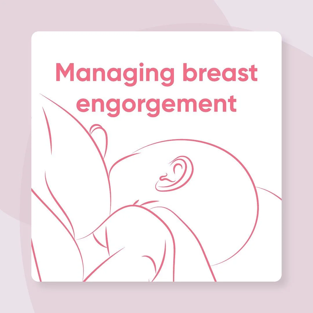 Managing breast engorgement Tips!

Here&rsquo;s how you can manage breast engorgement and get some relief: 

1⃣ Feed your baby frequently (8&ndash;12 times daily). 

2⃣ Check that your baby is latching effectively. 

3⃣ Express milk gently if your ba