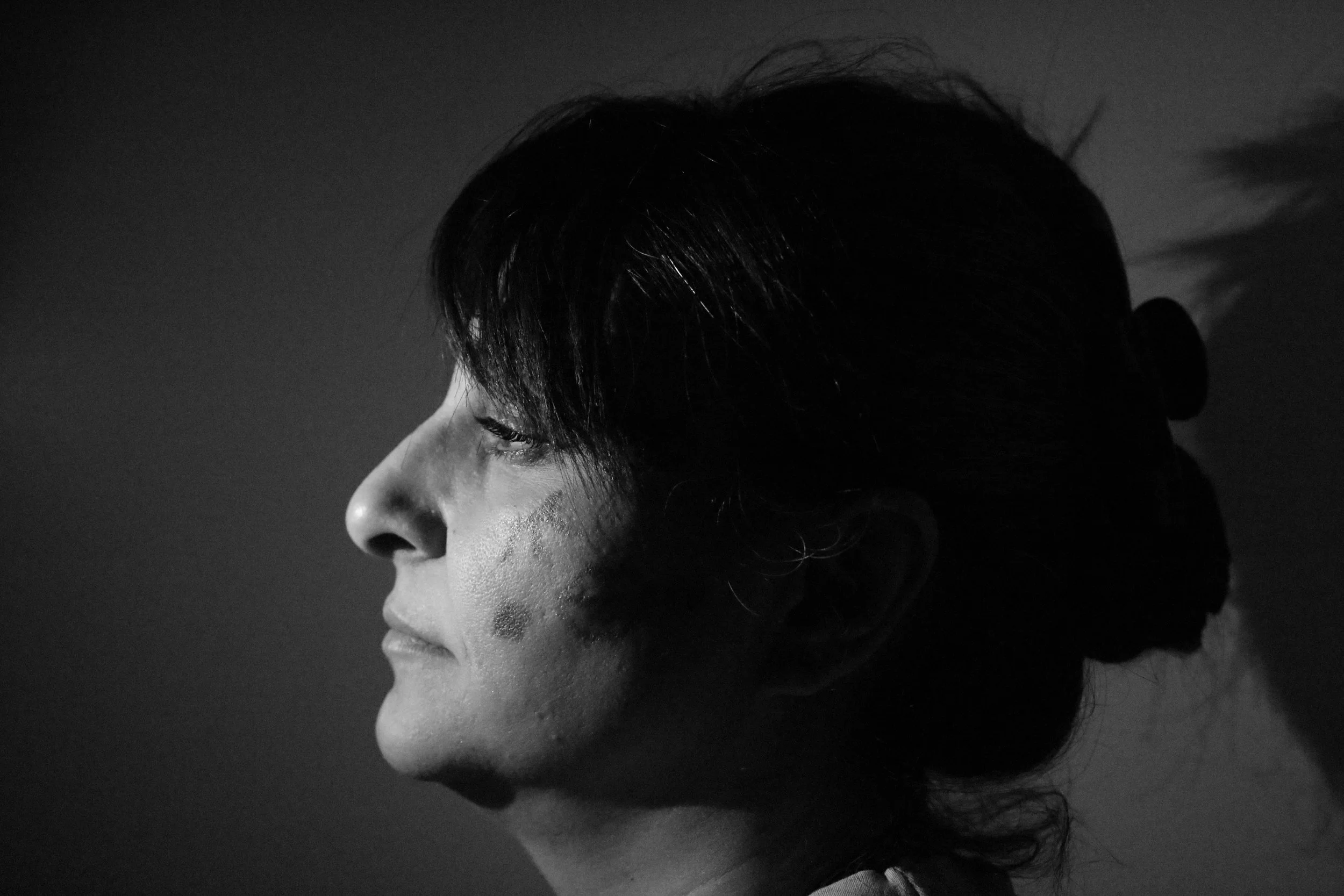 "Apple & Seed", 2024