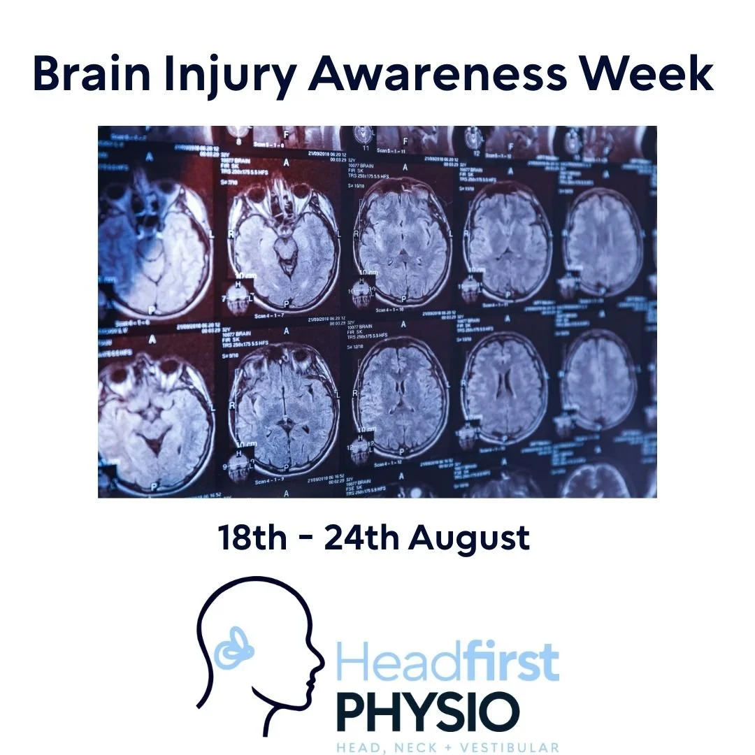 It's Brain Injury Awareness Week! 

Our vestibular physios can help with concussion, a mild traumatic brain injury.

Contact us today to make an appointment! 

#braininjuryawareness2025 #bendigophysios #vestibularphysiobendigo #concussion #mildbraini