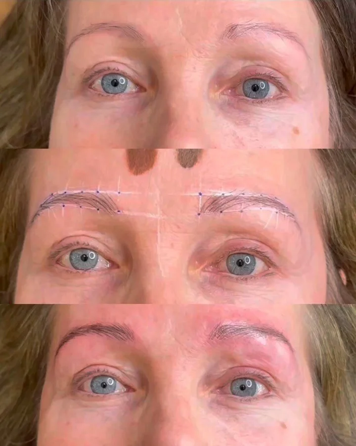 Let me tell you a little story about this beauty ✨
She had microblading done 5 years ago, but unfortunately her skin was damaged and left with scarring &mdash; which made my work quite a challenge. Still, with patience and persistence, the new stroke