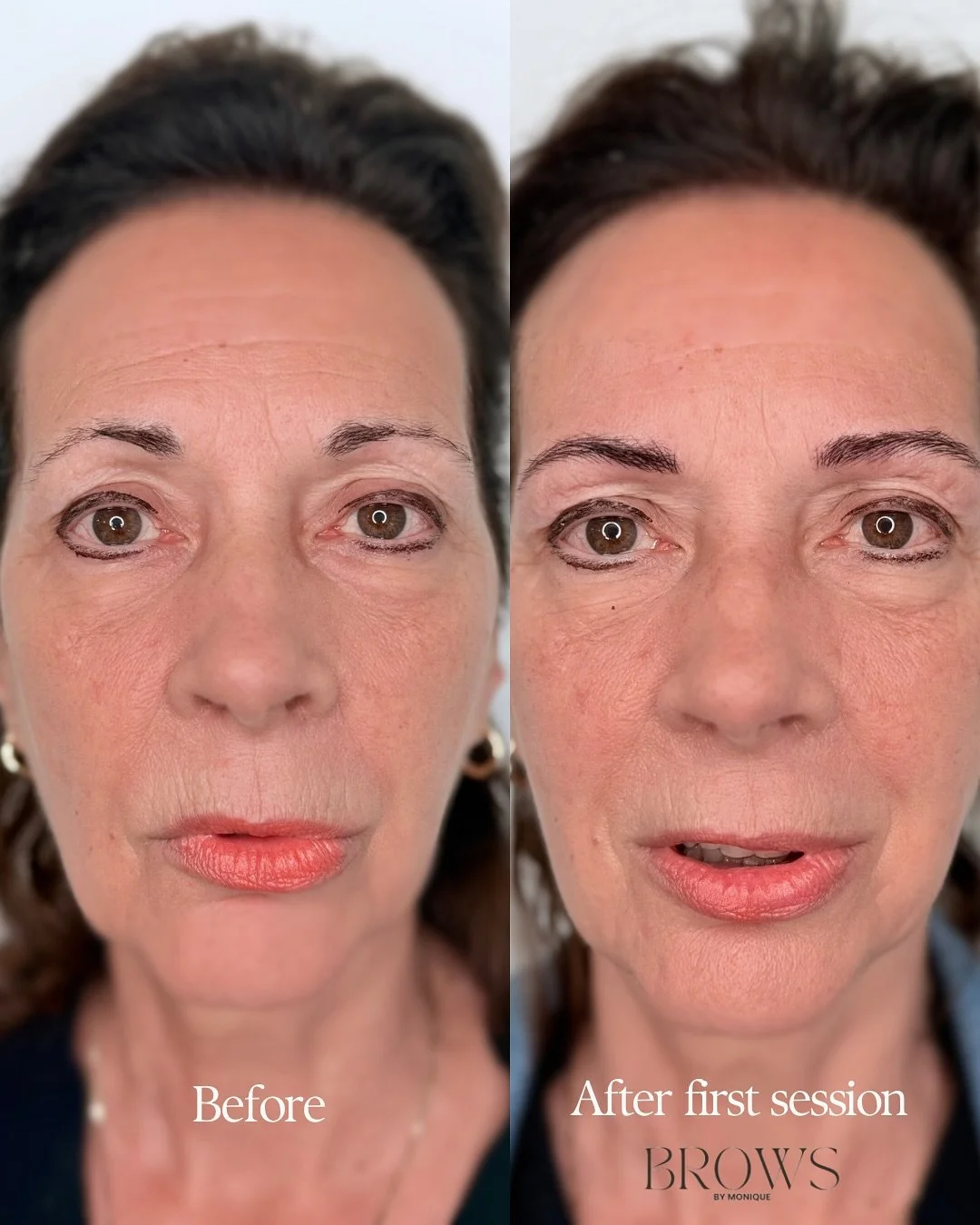 Good PMU Brows Can Turn Back Time

Hyperrealism Brows is a modern method of brow tattooing where each pattern is designed to mimic real brow hairs &mdash; for the most natural, realistic results you&rsquo;ll love.

Process: Before, immediately after 