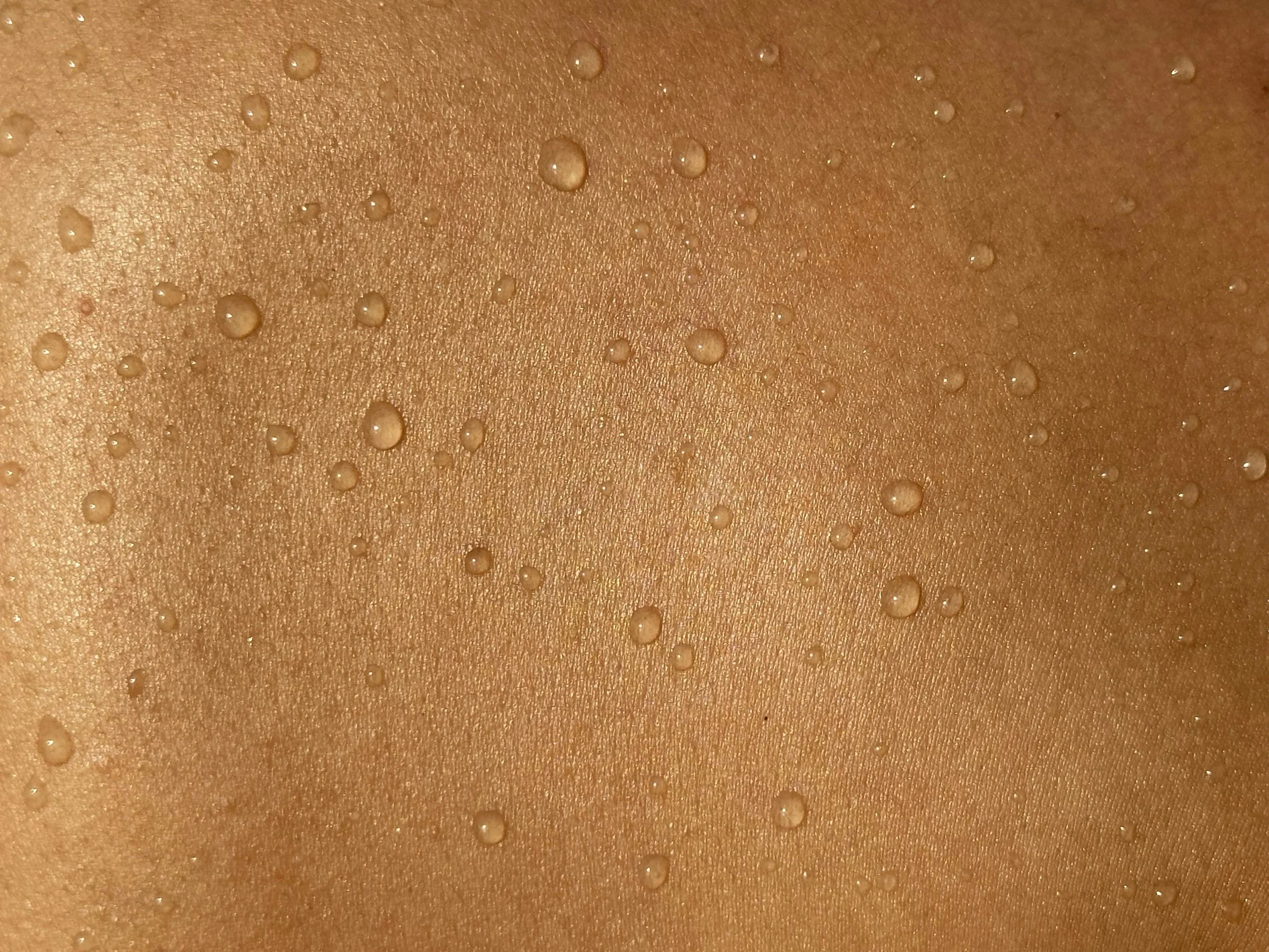 Vitiligo Education: What is the skin exactly?