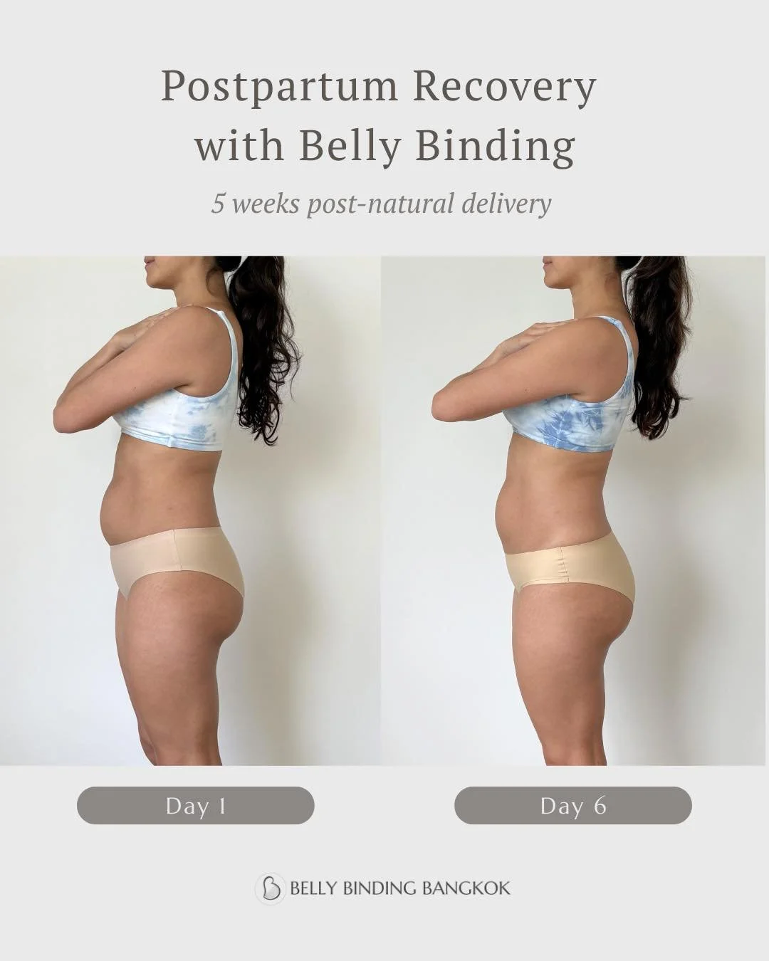 Can belly binding support postpartum recovery?

Here is one mama&rsquo;s progress after 6 sessions.

Mama K - 
Second natural birth &bull; 5 weeks postpartum

Diastasis recti: 3 &rarr; &frac12; finger gap
Belly measurement: &ndash;4 cm

This mama is 