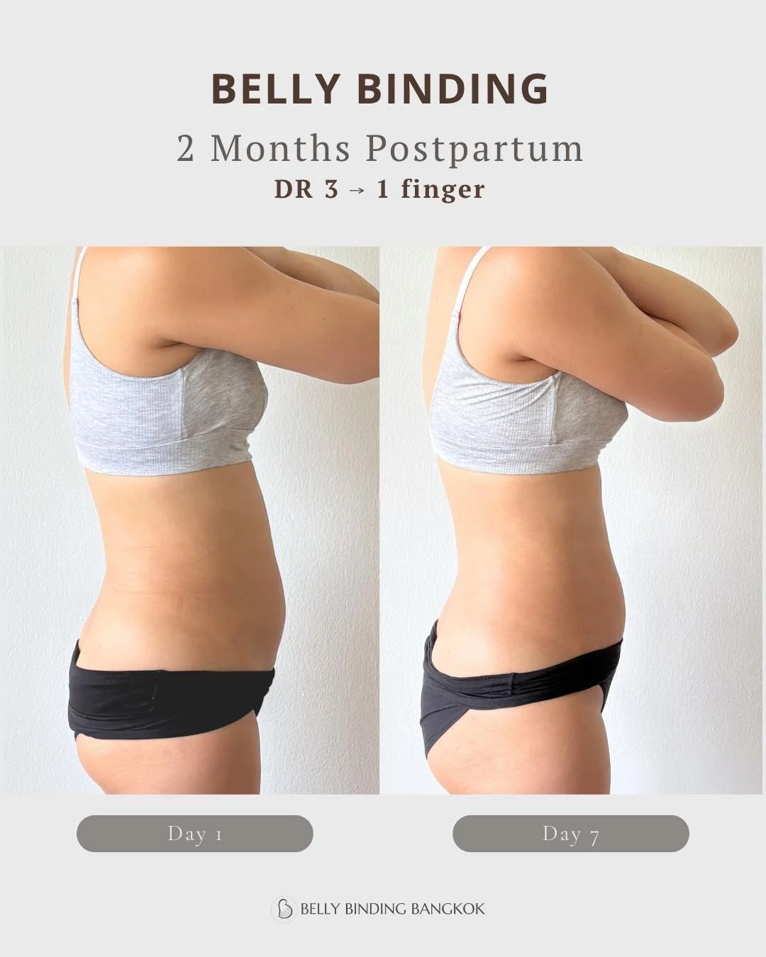 Her belly didn&rsquo;t need more crunches. It needed support.

2 months postpartum after C-section. 
7 days of belly binding support.

✨ Diastasis recti (DR) improved from 3 fingers &rarr; 1 finger 
✨ Belly circumference reduced from 80cm &rarr; 78cm