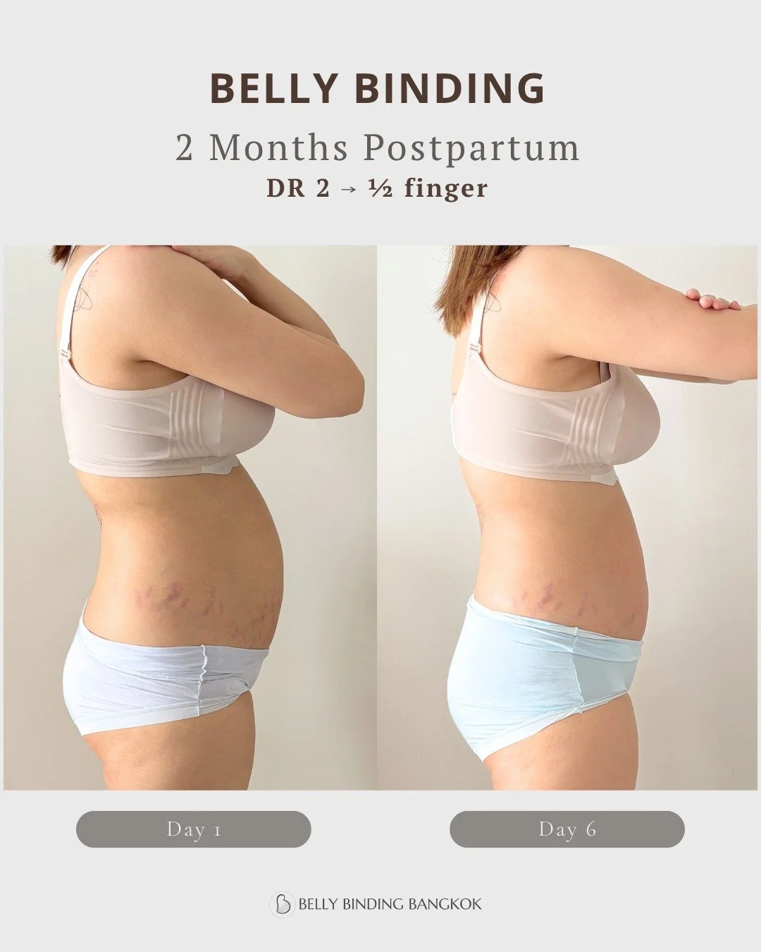 First-time mom. C-section birth. 2 months postpartum&mdash;and finally feeling supported again.

At 2 months postpartum, this first-time Thai mama completed a 6-day belly binding program after finishing her Yu Fai recovery.

Like many C-section moms,