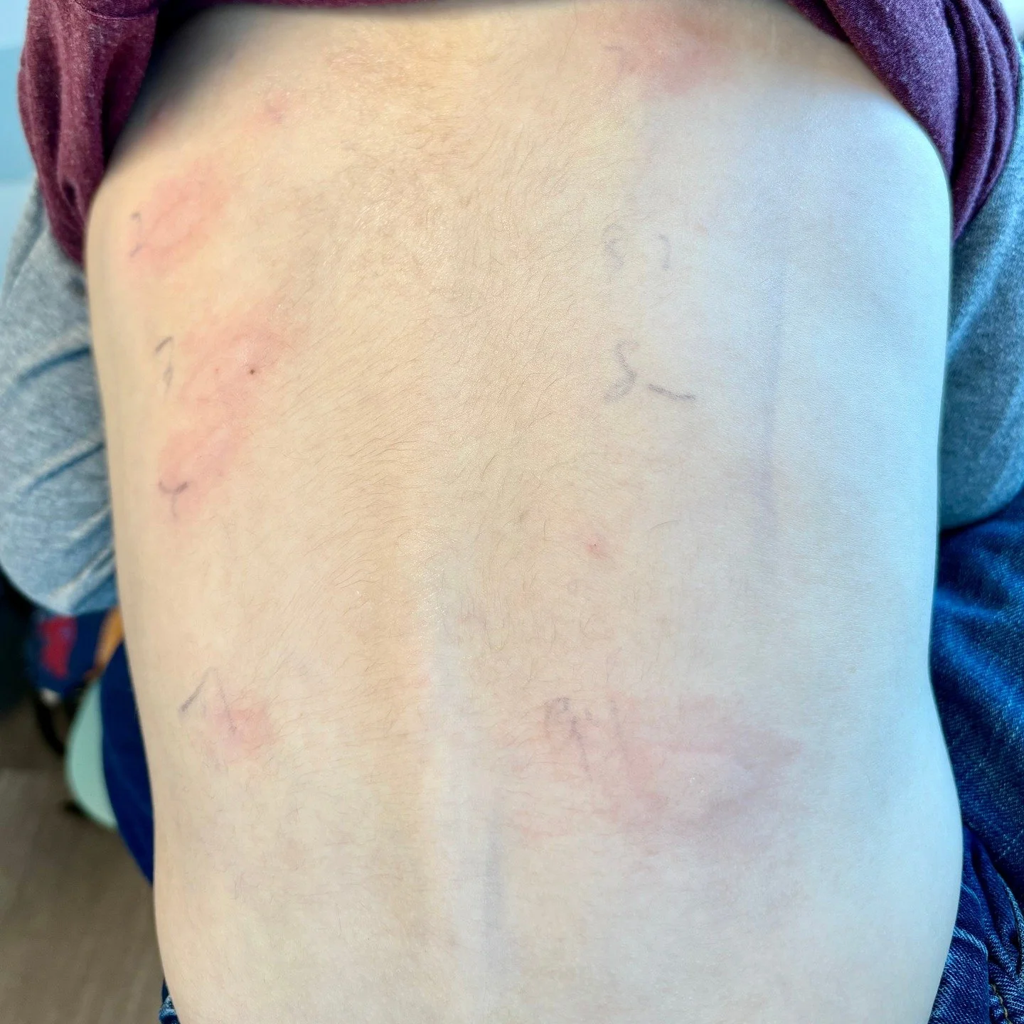 This is our "why". 
This is why your everything bagels use flax instead of sesame seeds. 
This is why we have dairy and egg free options. 
This is why you'll never see peanut butter in our baked goods. 

Annual allergy testing is always ner