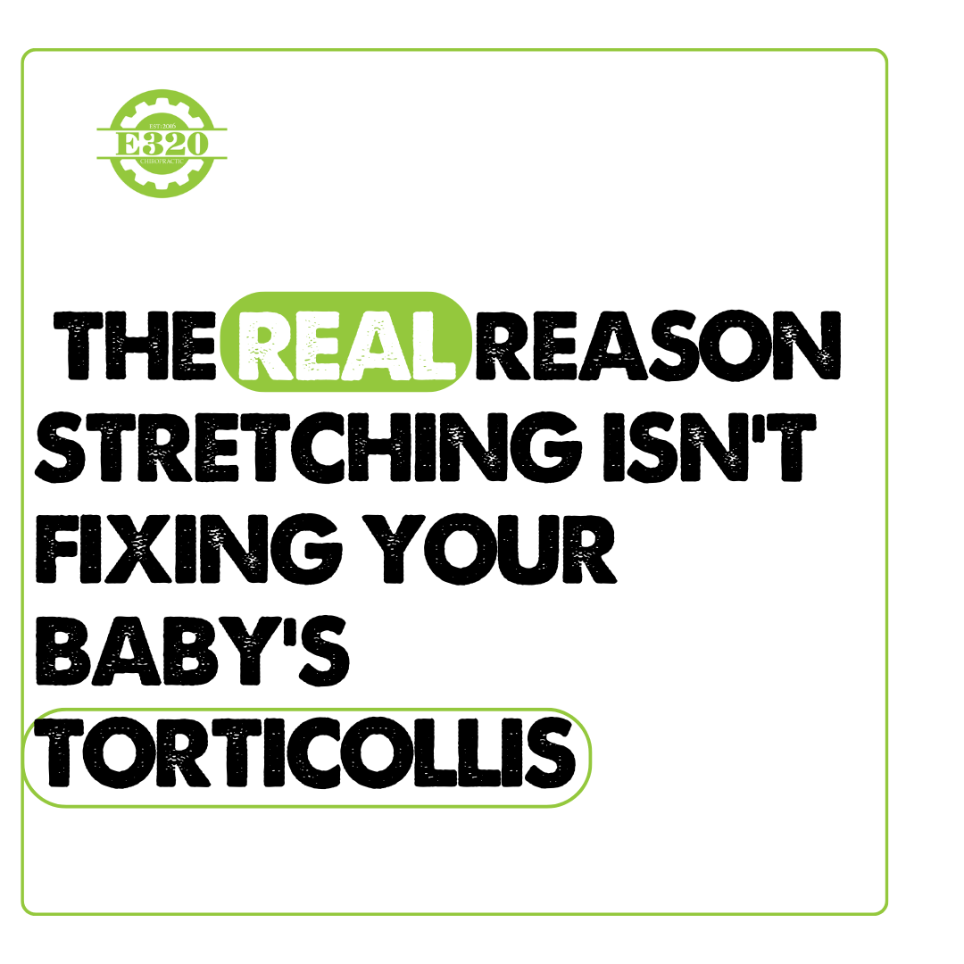 The Real Reason Stretching Isn’t Fixing Your Baby’s Torticollis