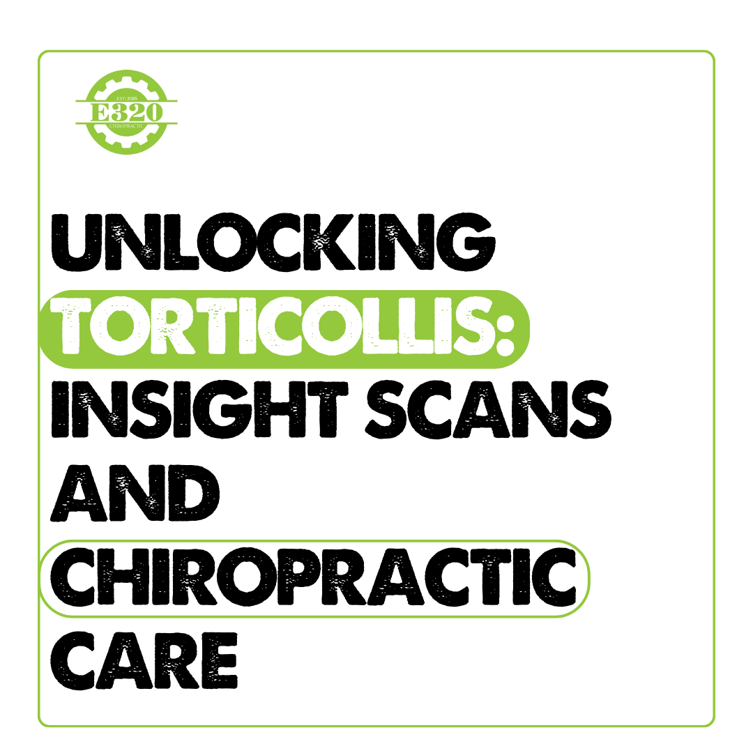 Unlocking Torticollis: INSiGHT Scans and Chiropractic Care